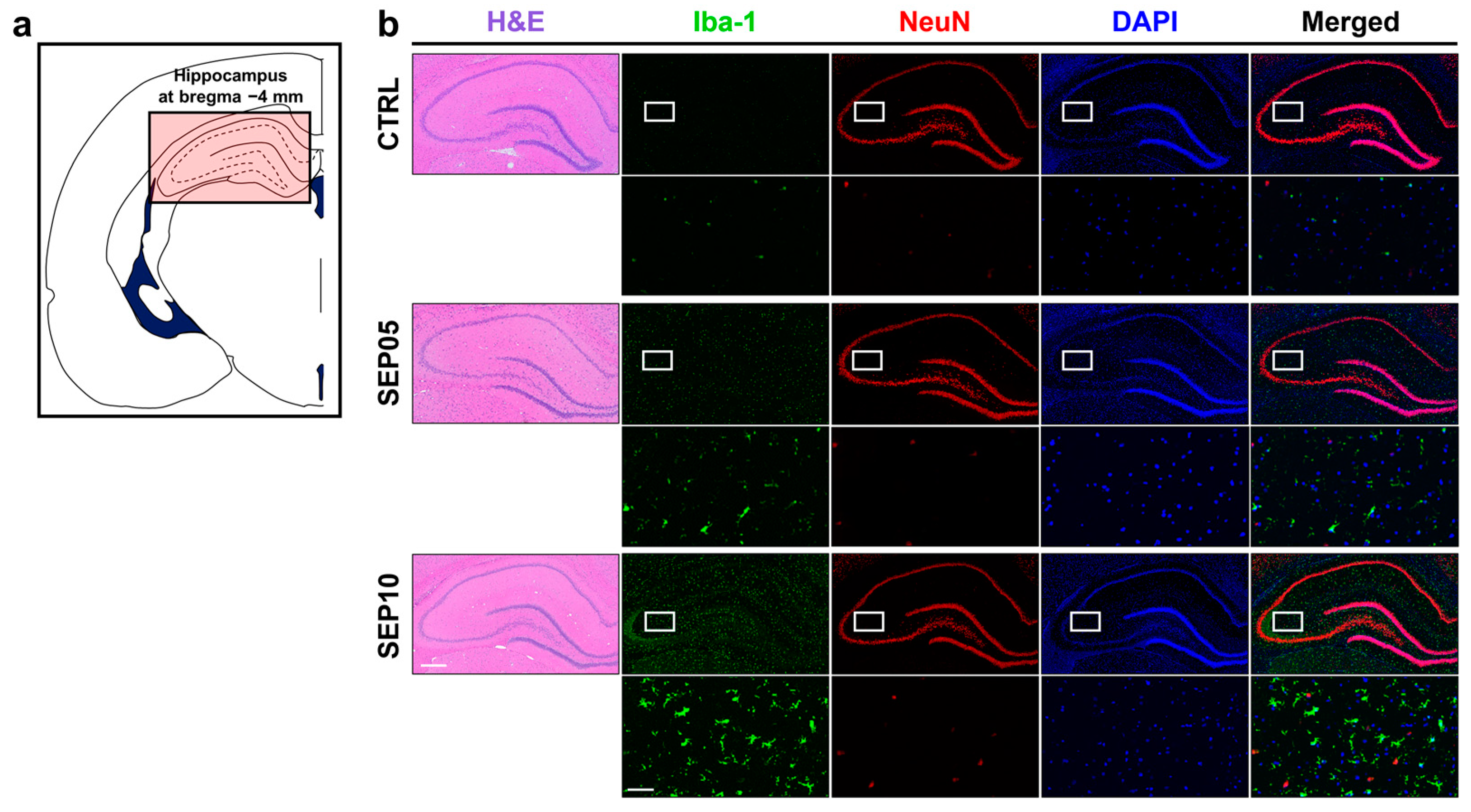 Metabolites 13 00636 g004 Metabolites 13 00636 g004