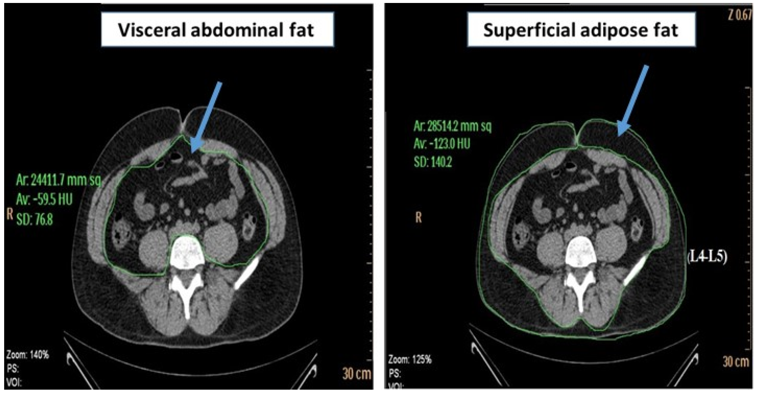 Metabolites 13 00896 g004