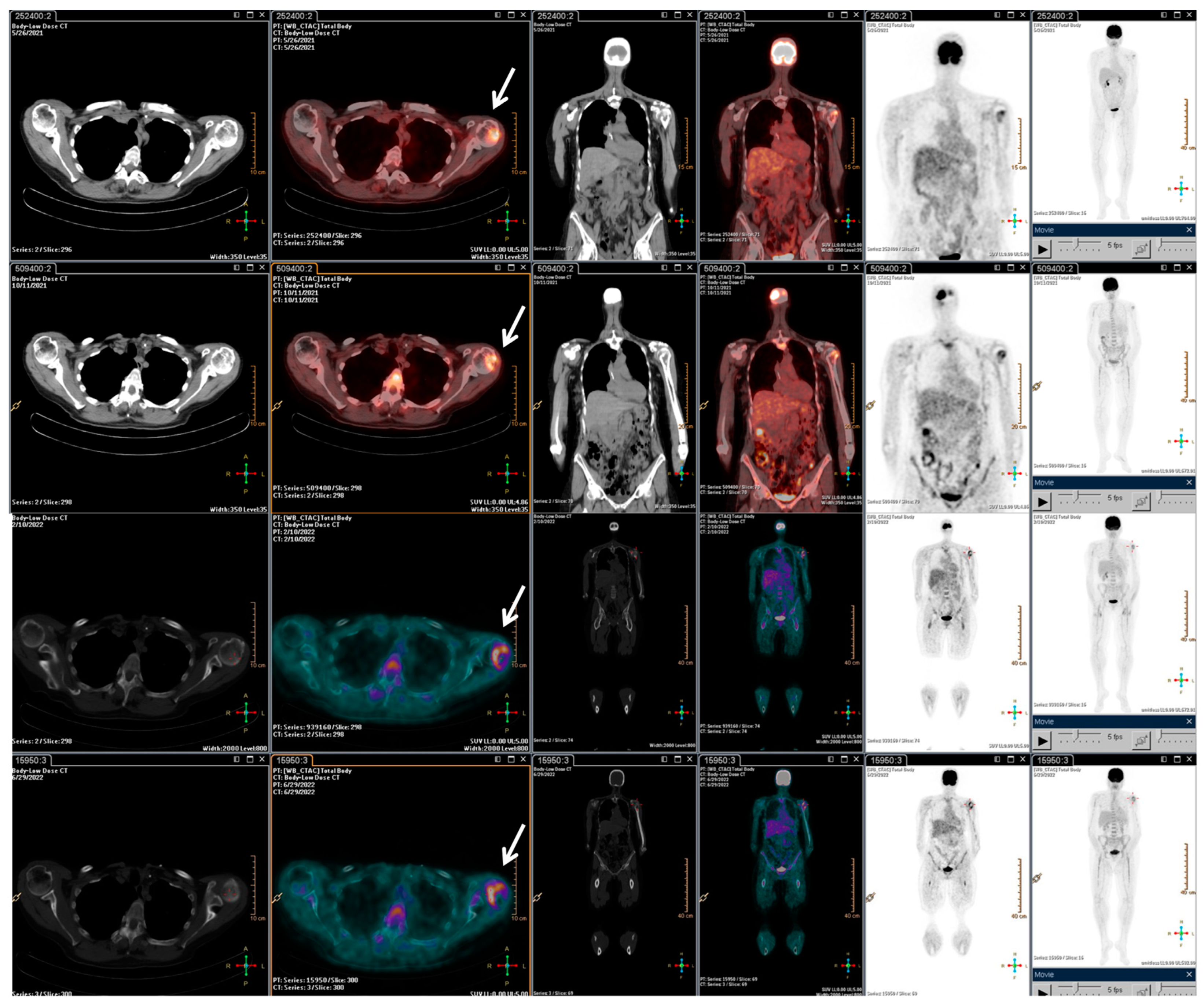 Metabolites 13 01035 g003