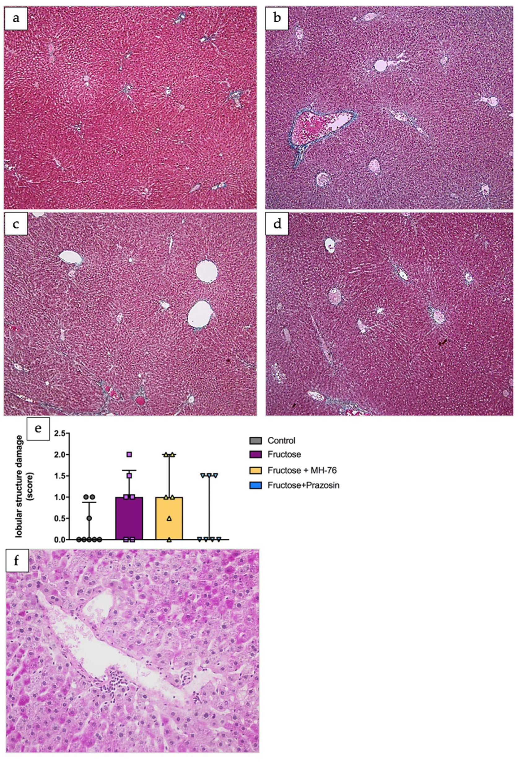 Metabolites 13 01130 g005
