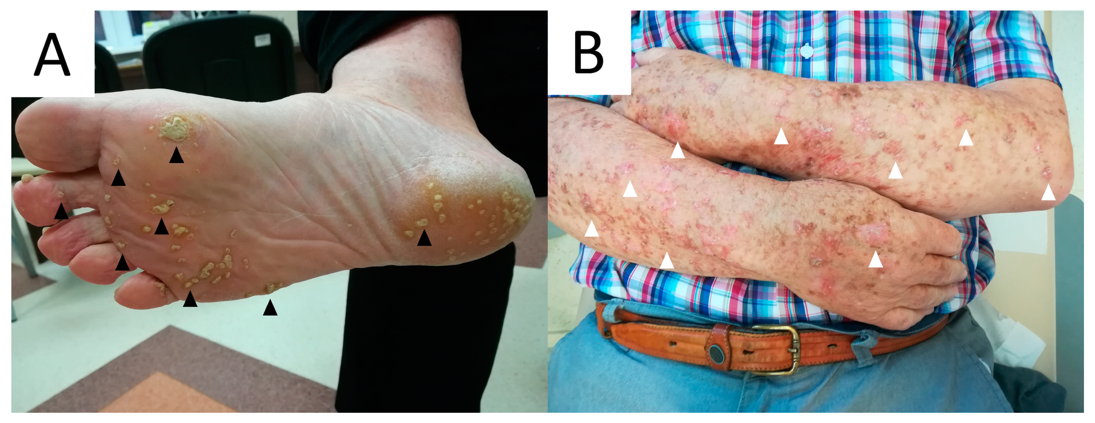 Metabolites 13 01176 g013
