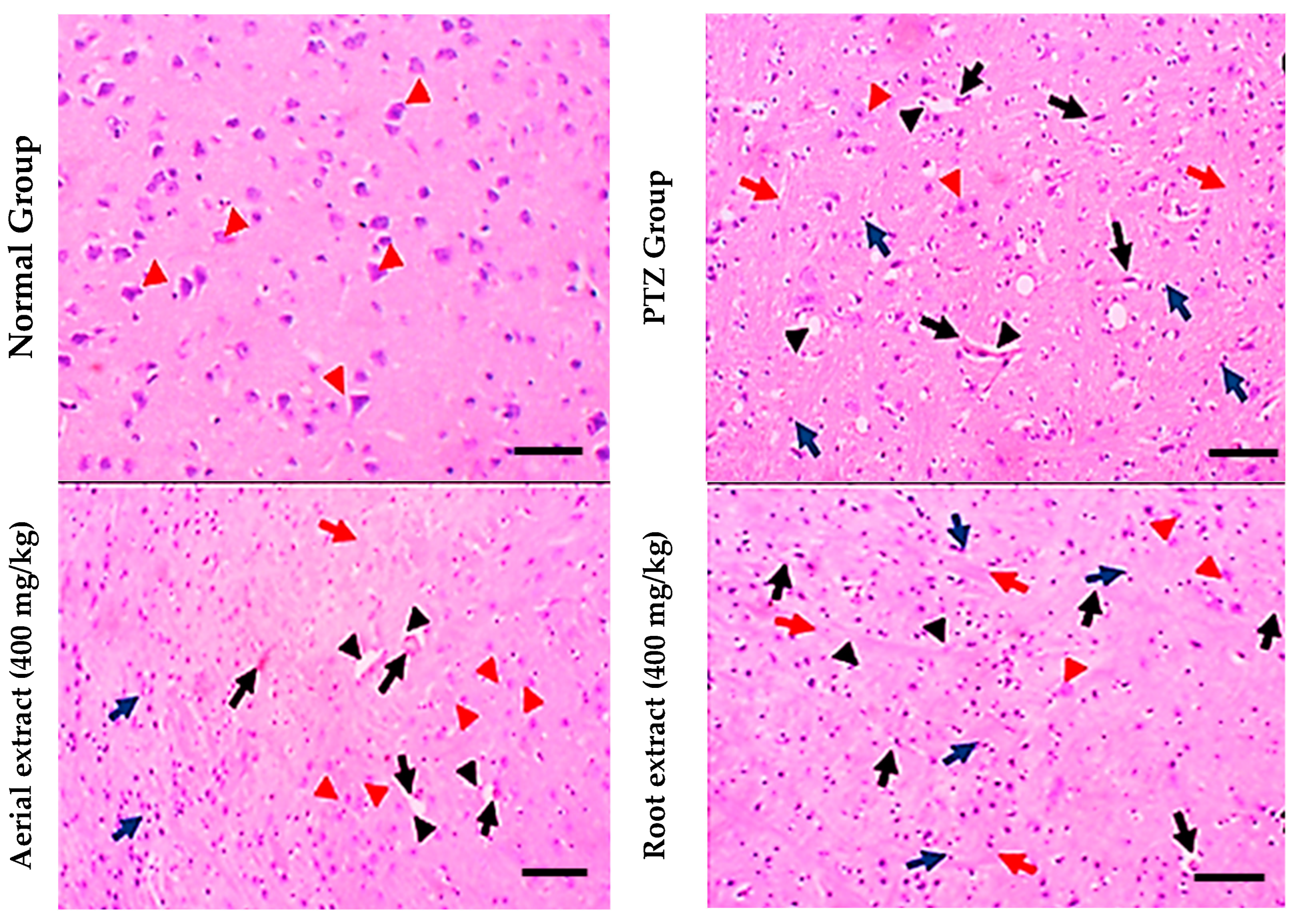 Metabolites 14 00316 g005
