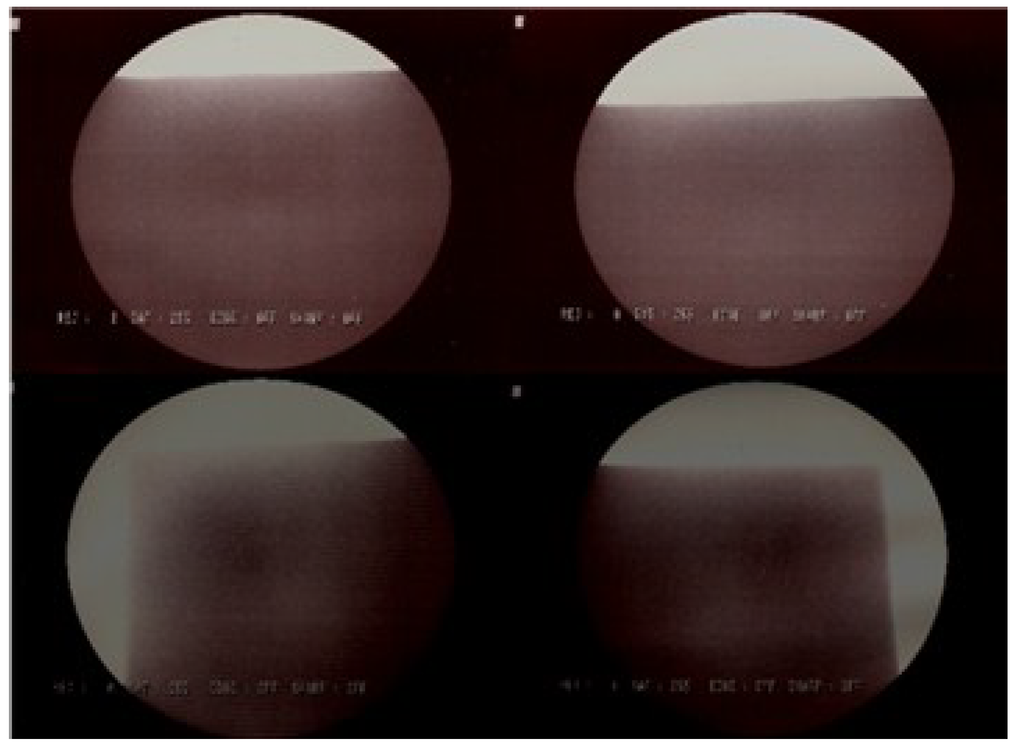 Metals 05 00706 g014 1024