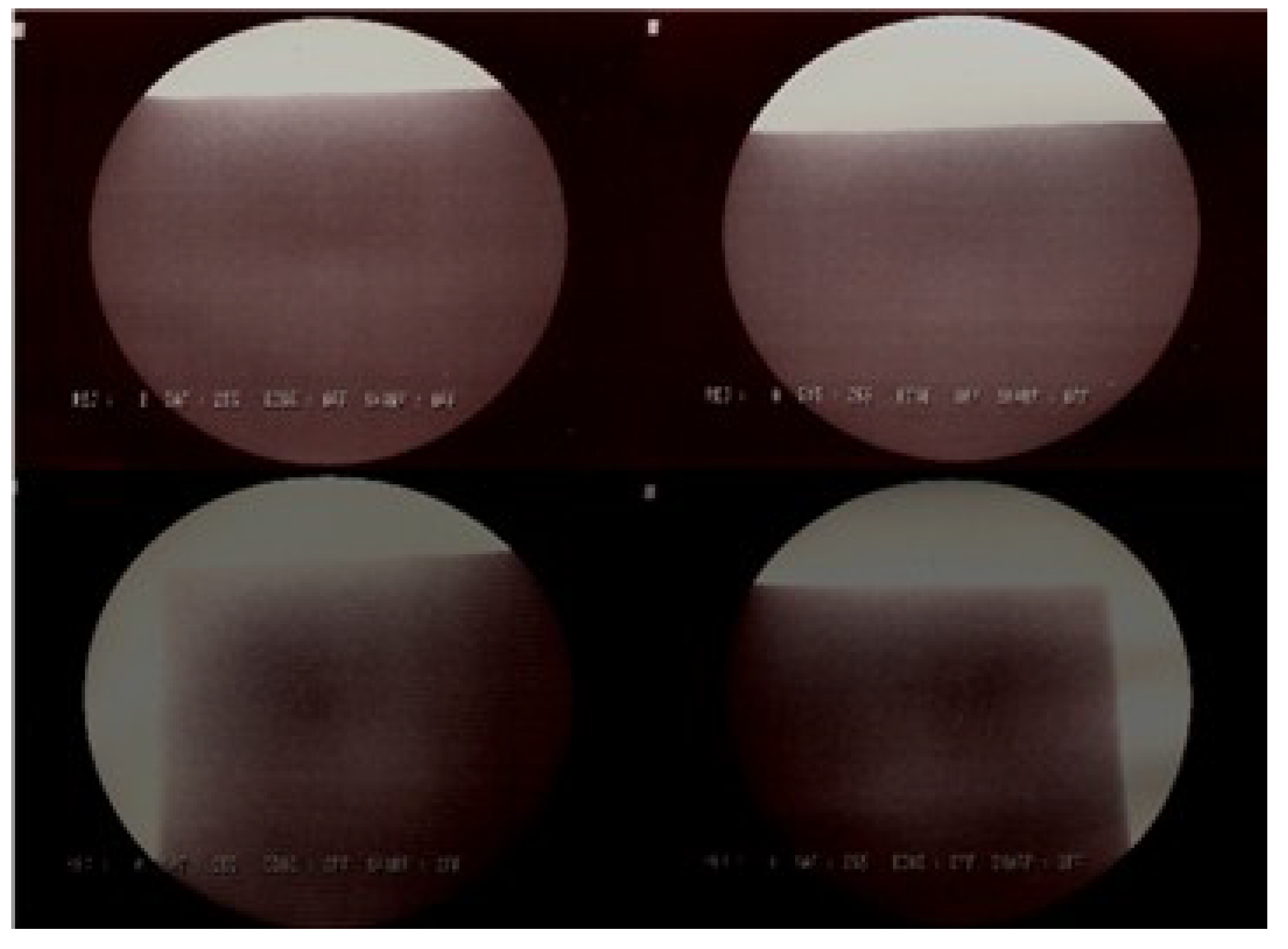 Metals 05 00706 g014