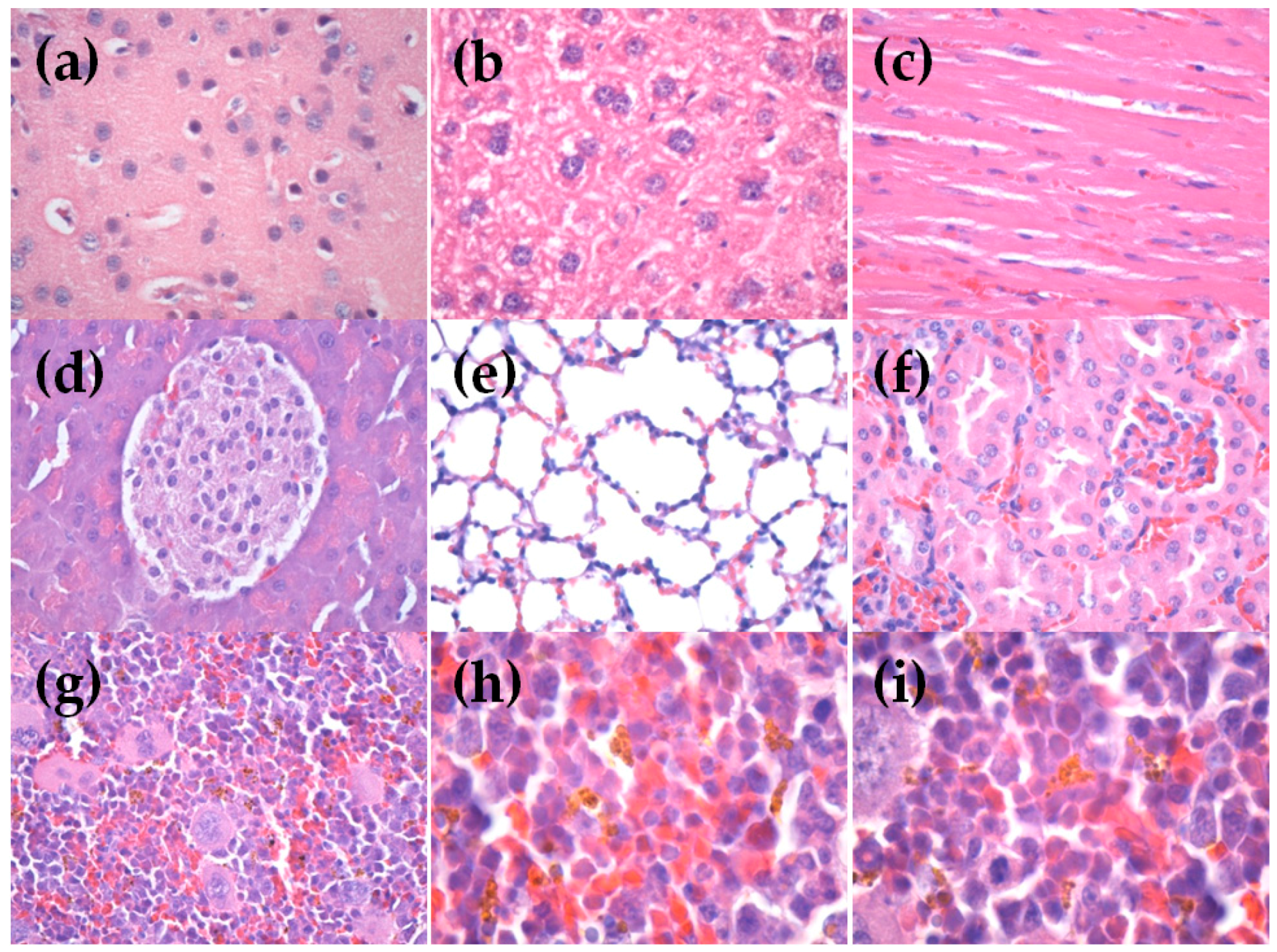 Metals 06 00103 g006