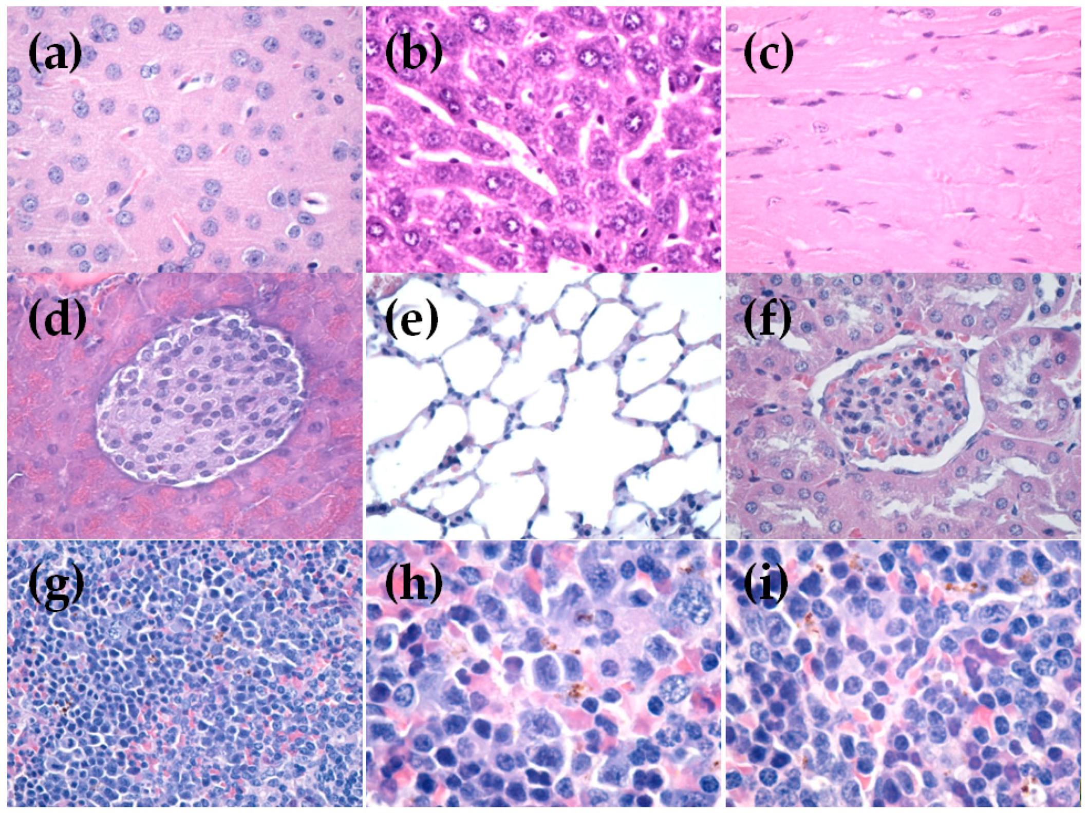 Metals 06 00103 g007