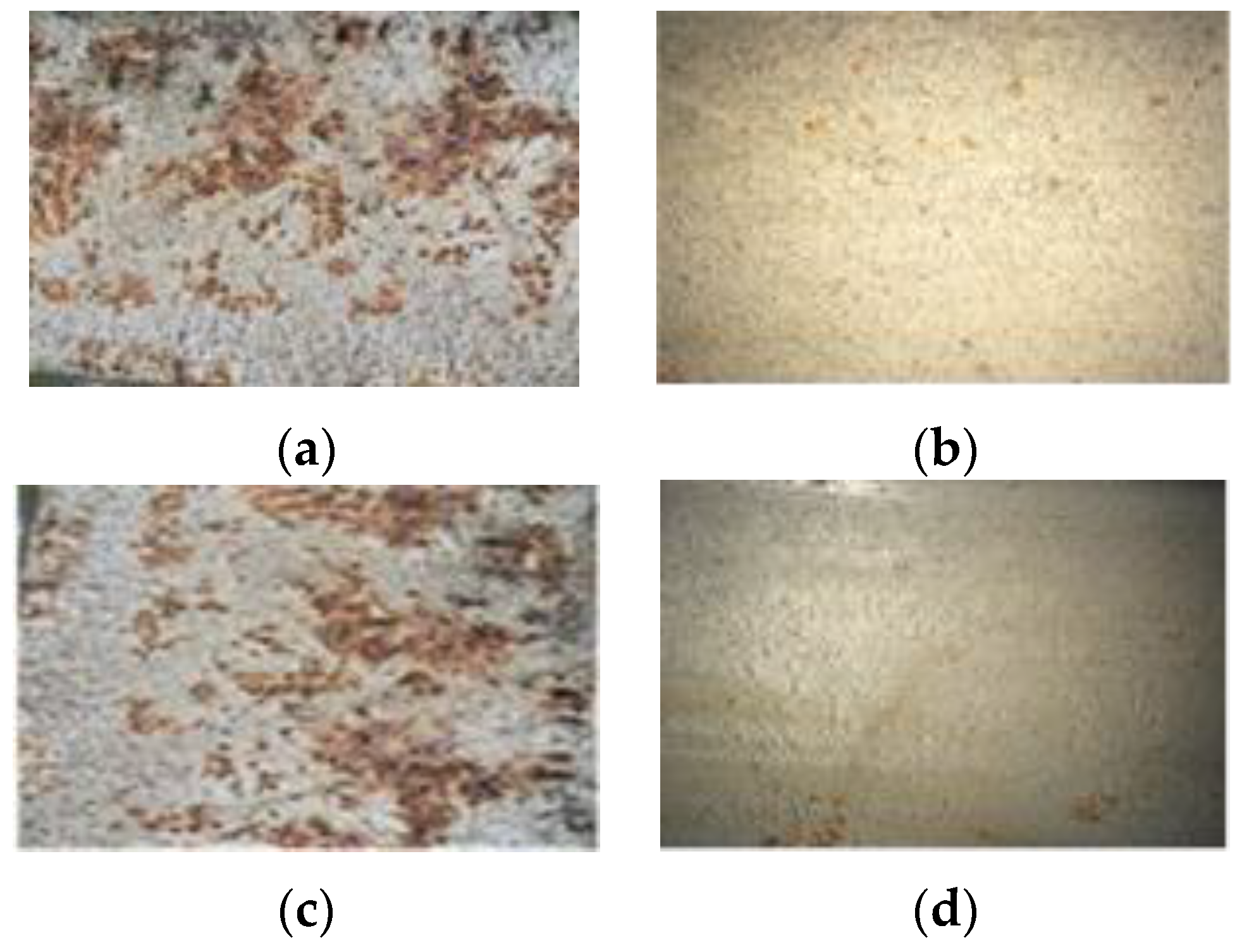 Metals 06 00247 g008