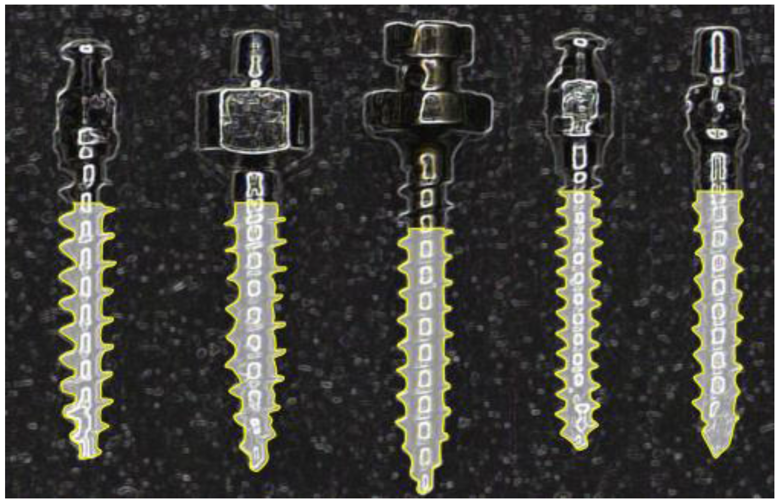 Metals 07 00112 g007