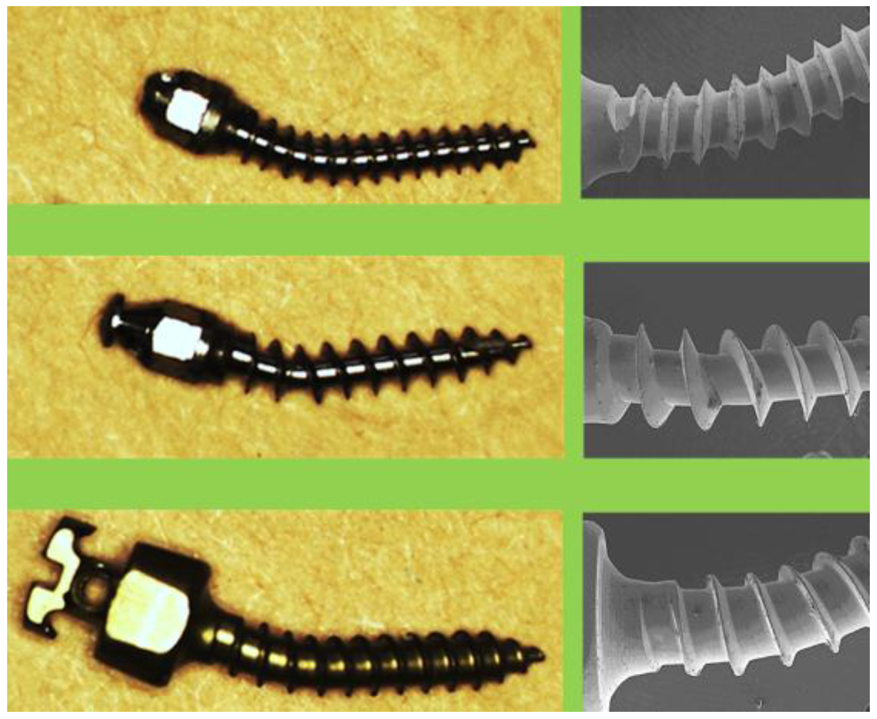 Metals 07 00112 g008