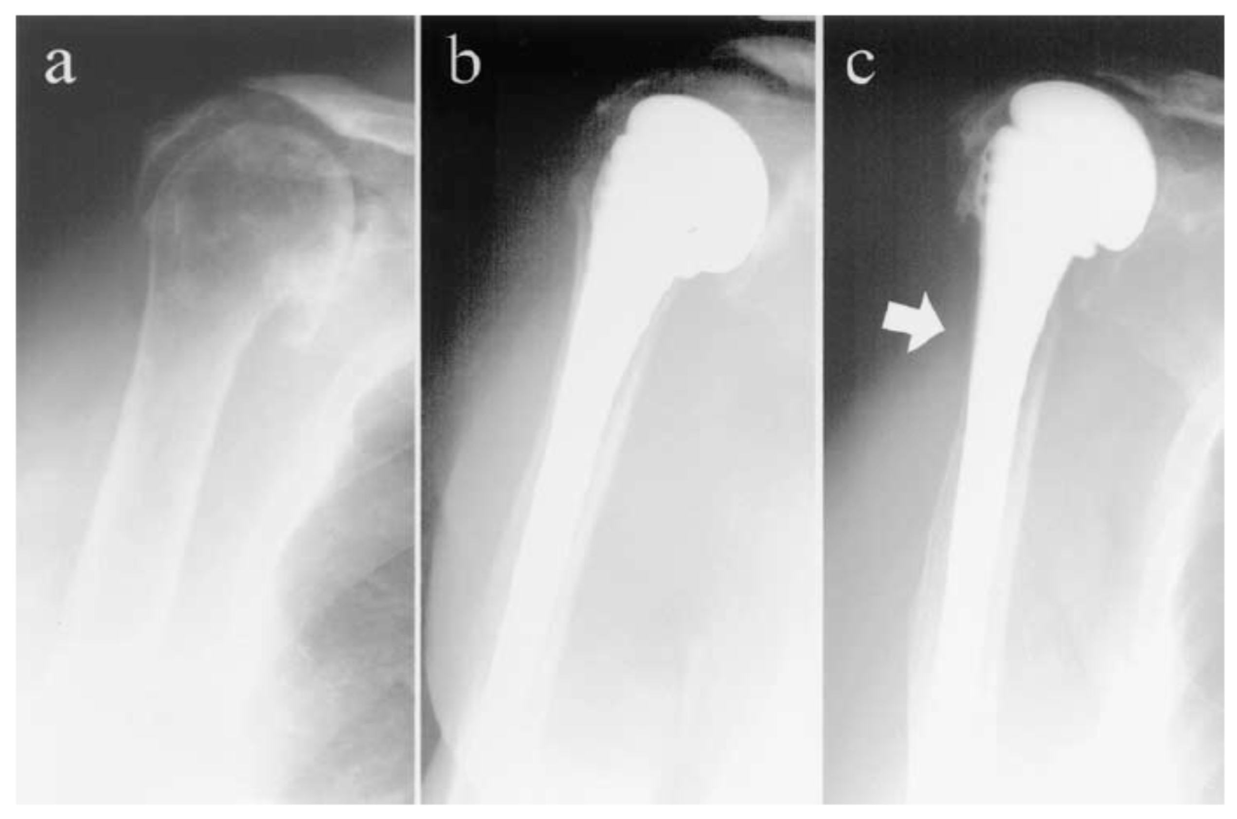 Metals 07 00252 g002