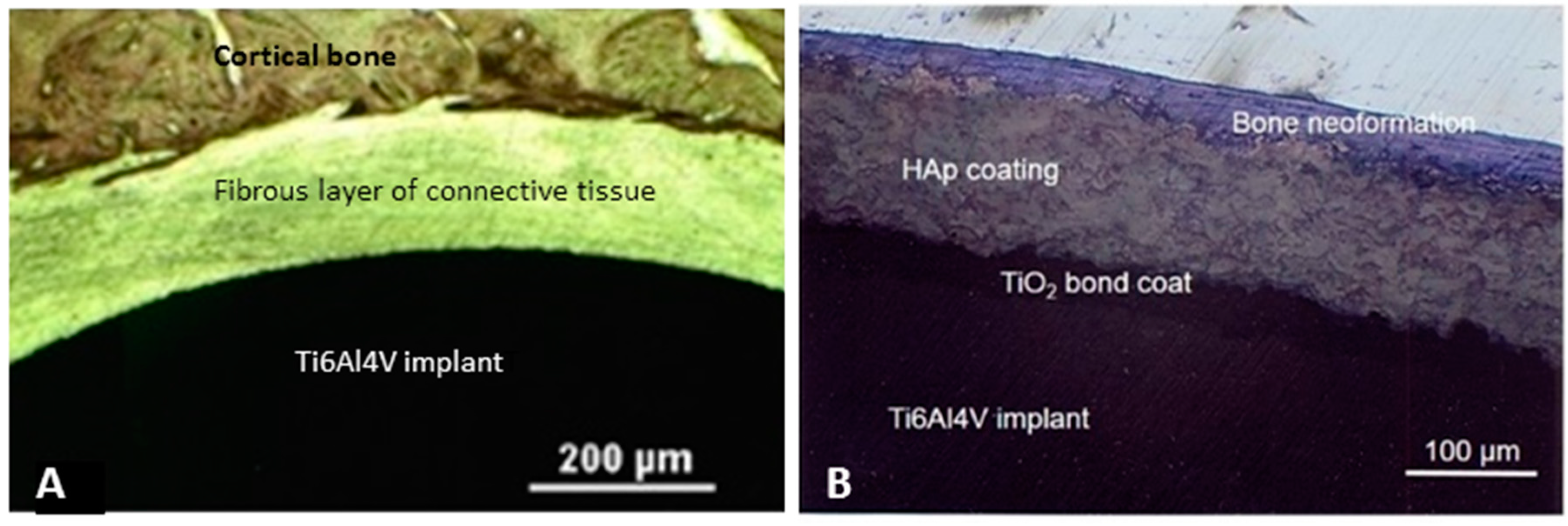Metals 07 00468 g001