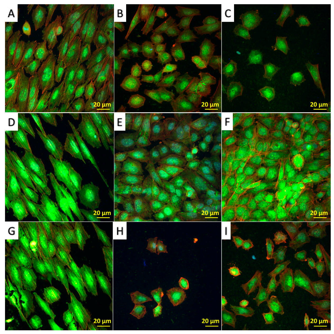 Metals 08 00029 g003