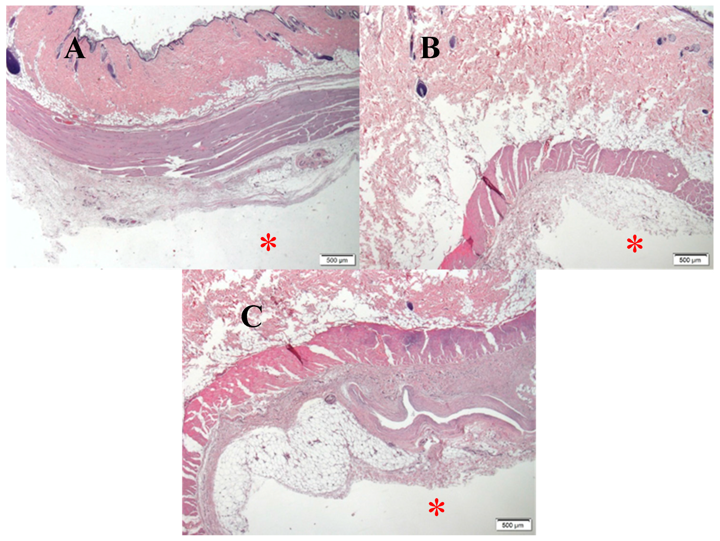 Metals 08 00153 g016