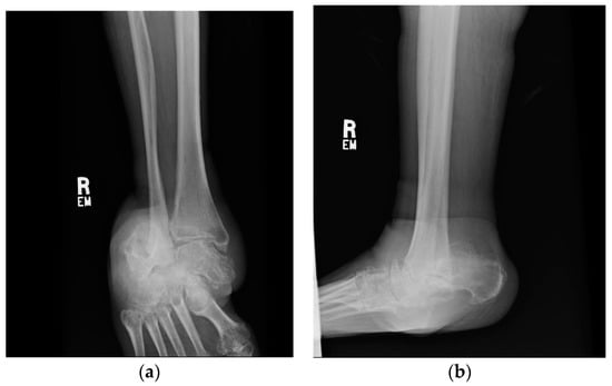 Metals 08 00180 g0a1