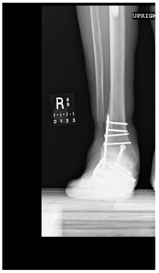 Metals 08 00180 g0a5