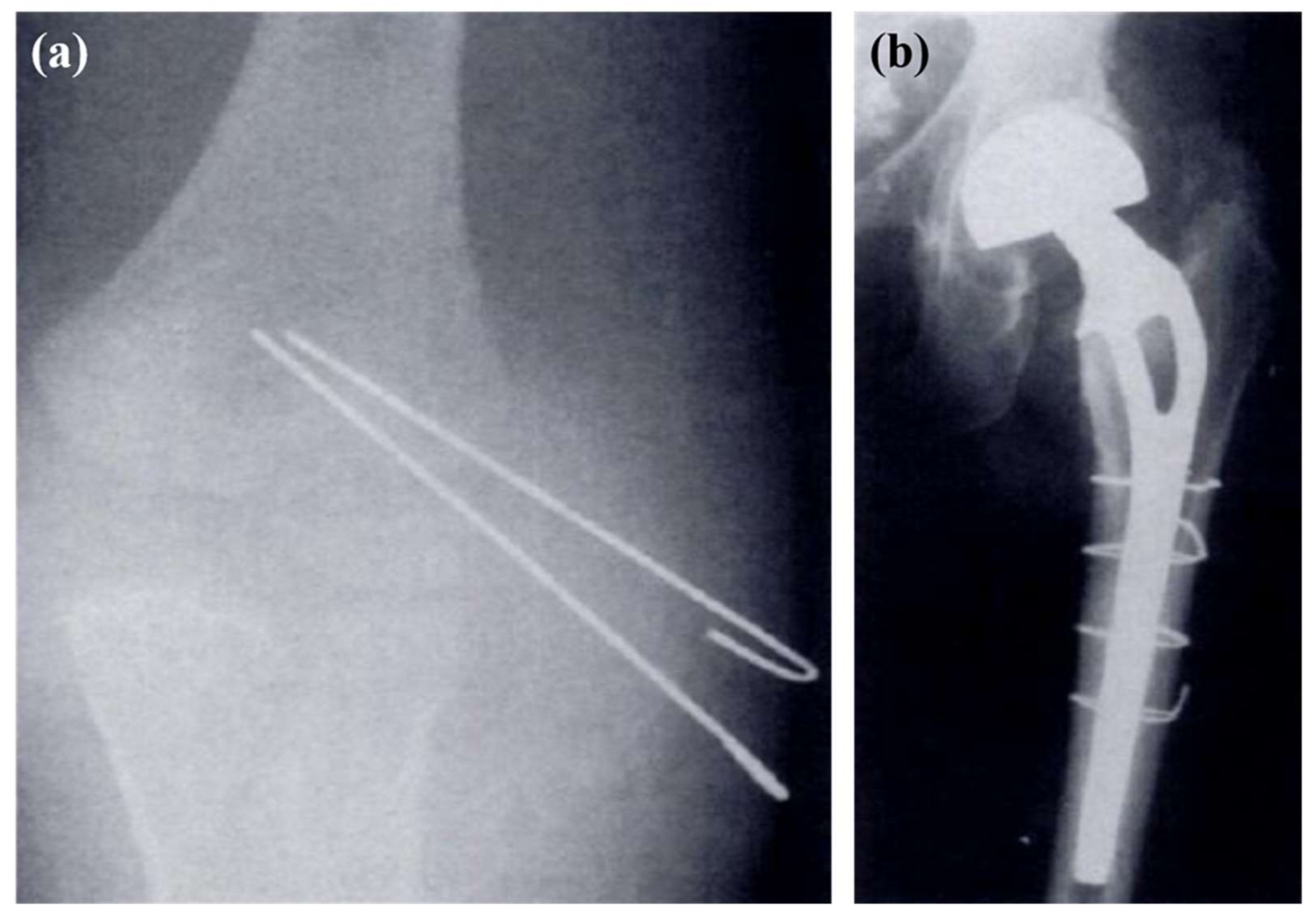 Metals 08 00212 g004