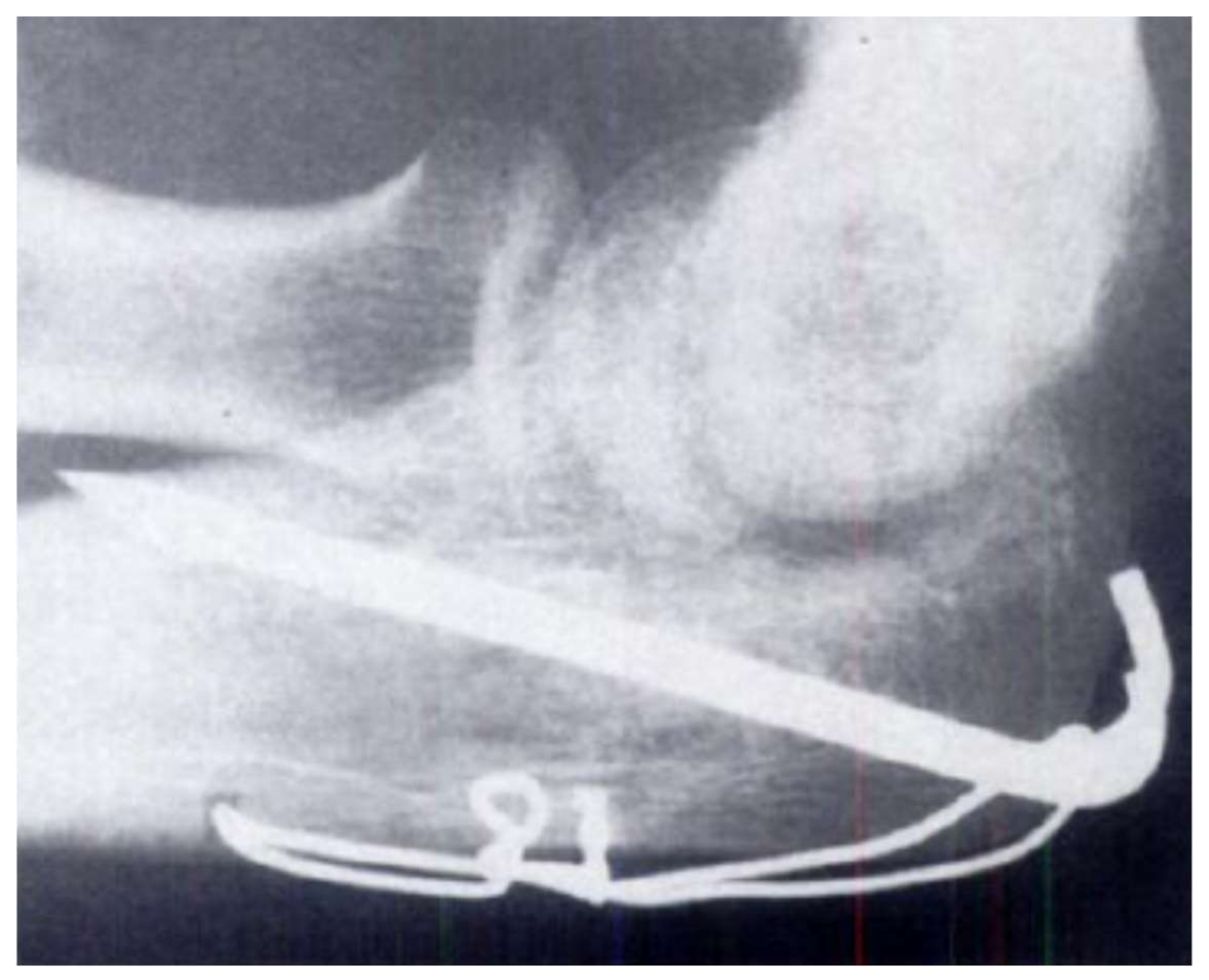 Metals 08 00212 g005