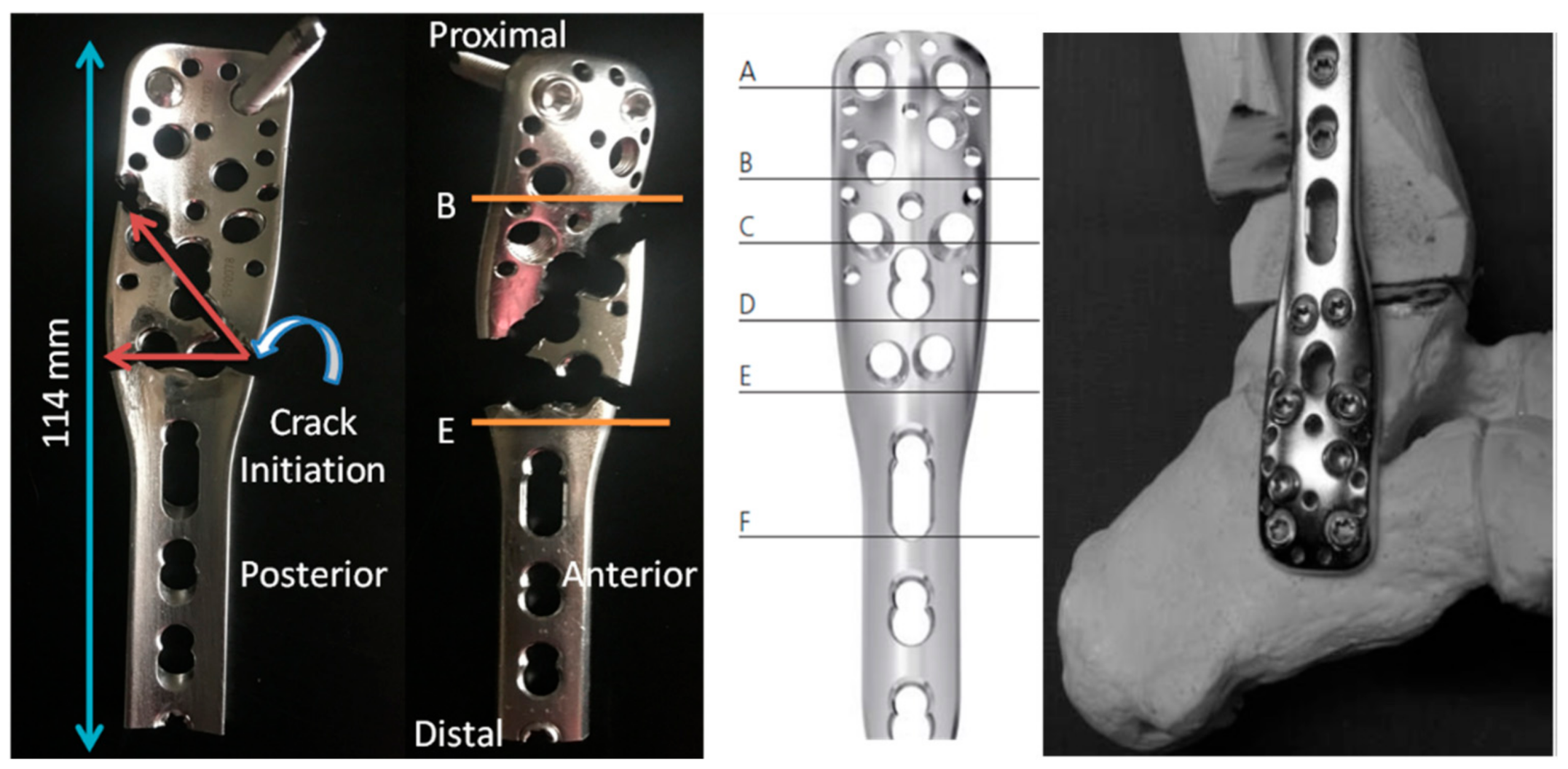 Metals 08 00279 g001