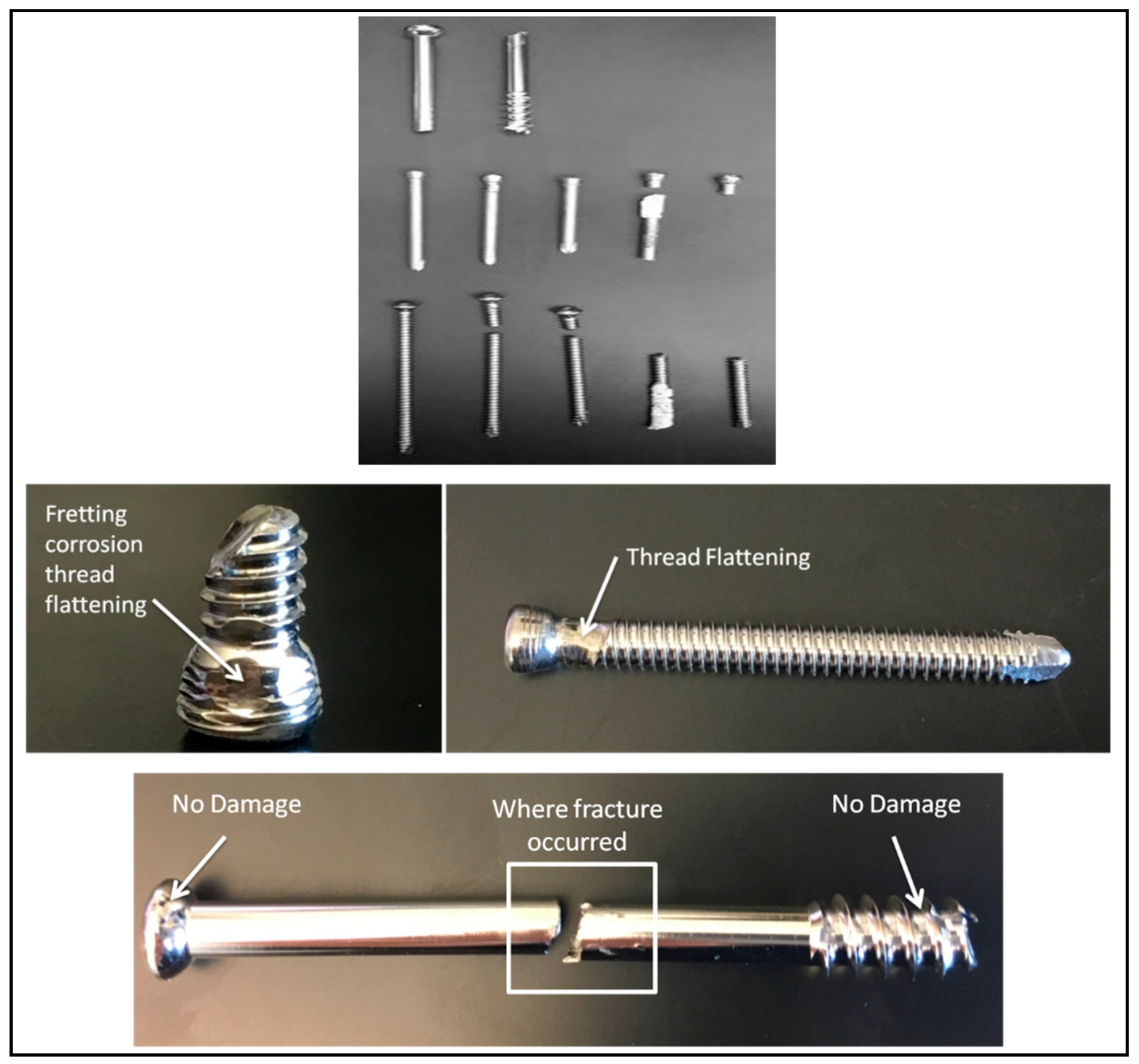 Metals 08 00279 g002