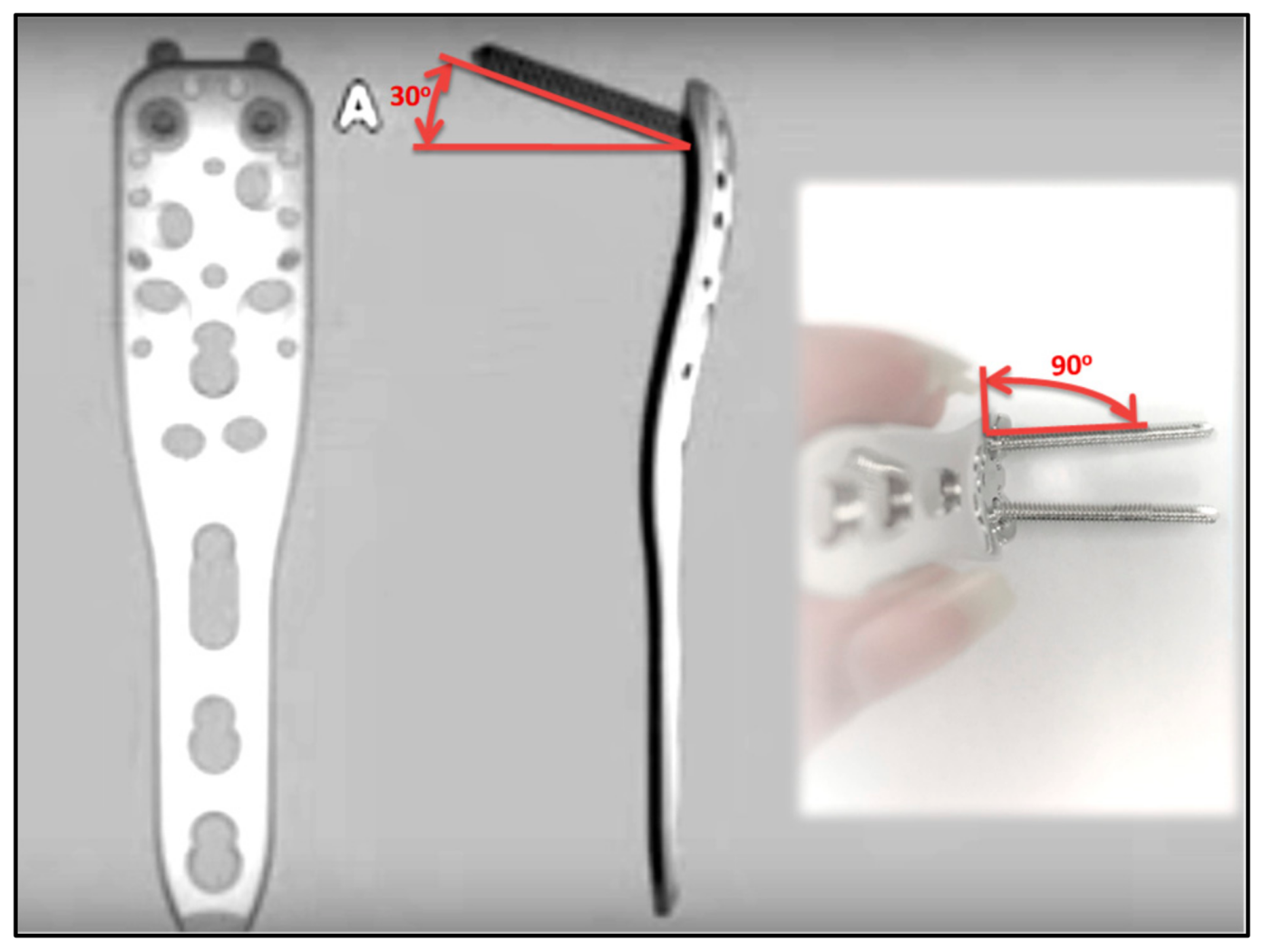 Metals 08 00279 g006