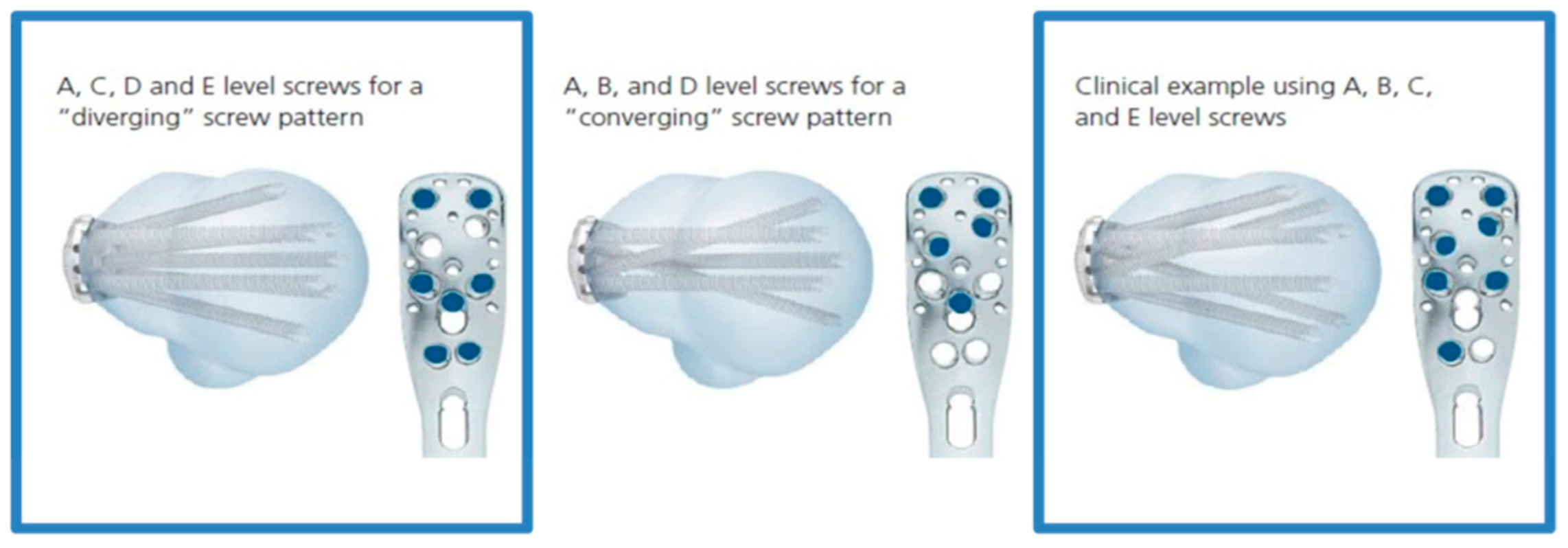 Metals 08 00279 g008