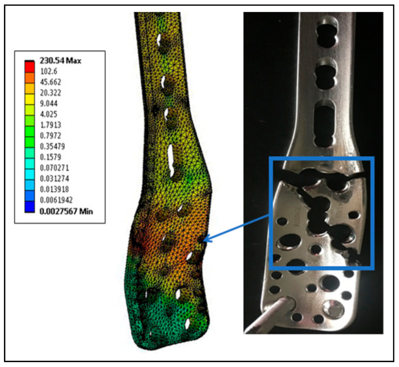 Metals 08 00279 g009