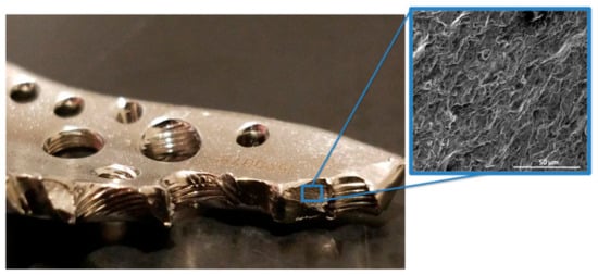 Metals 08 00279 g0a1 550