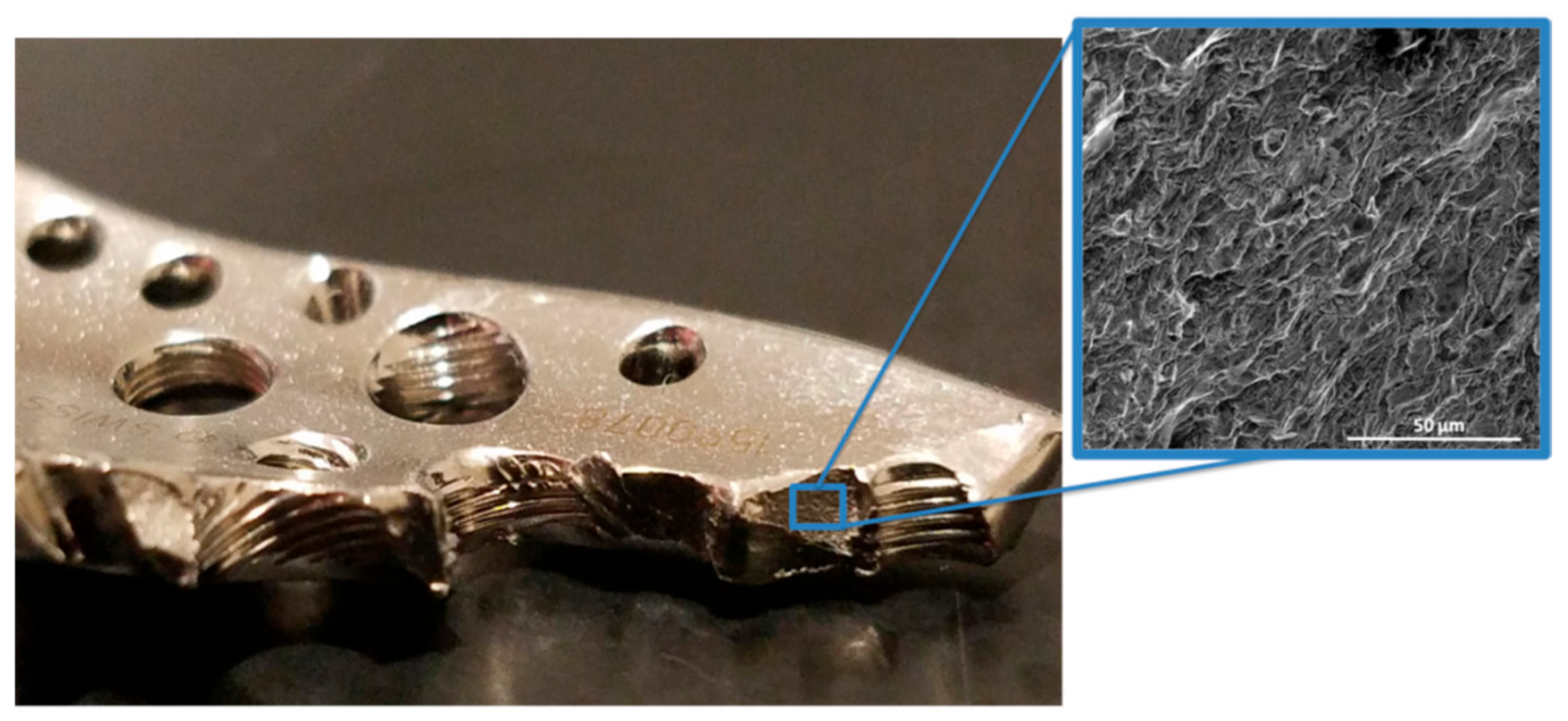 Metals 08 00279 g0a1