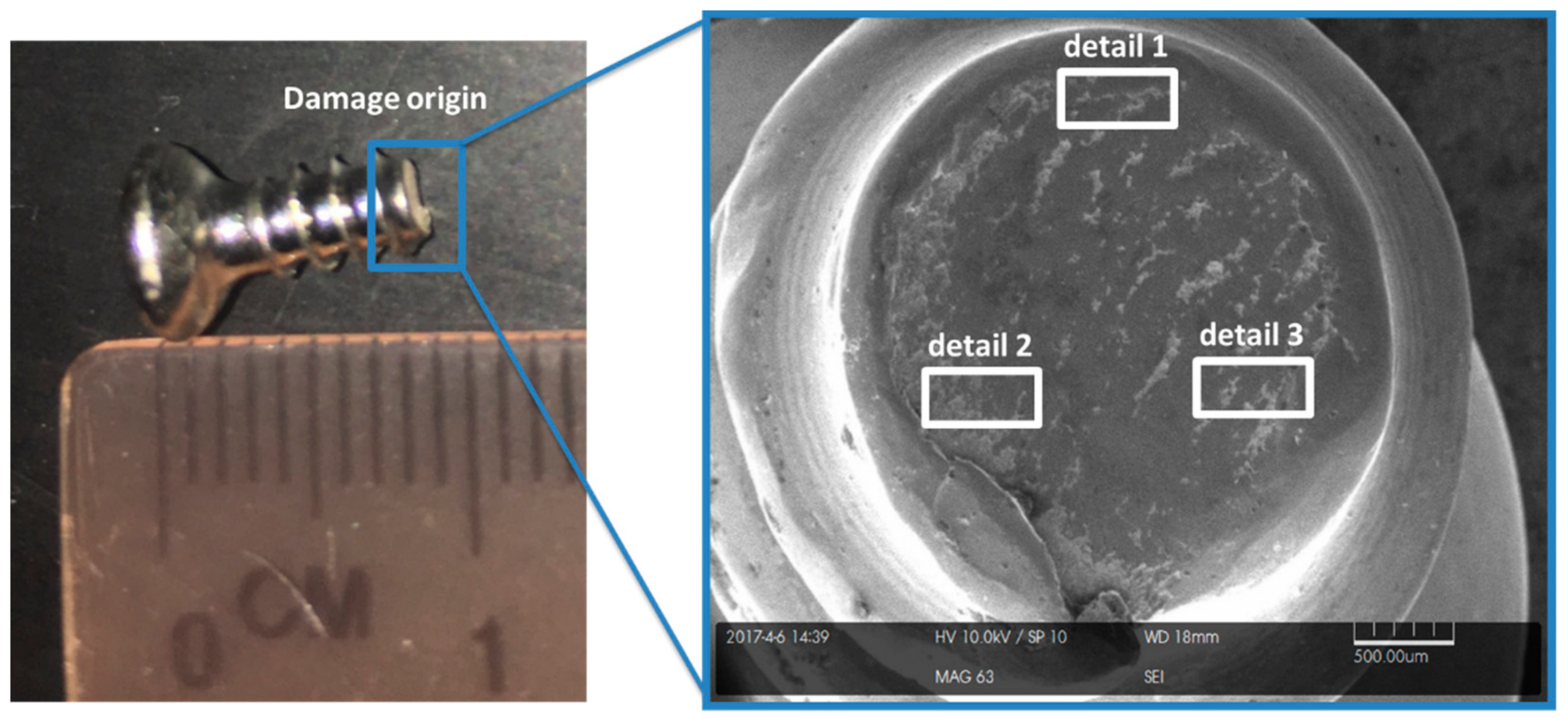 Metals 08 00279 g0a2