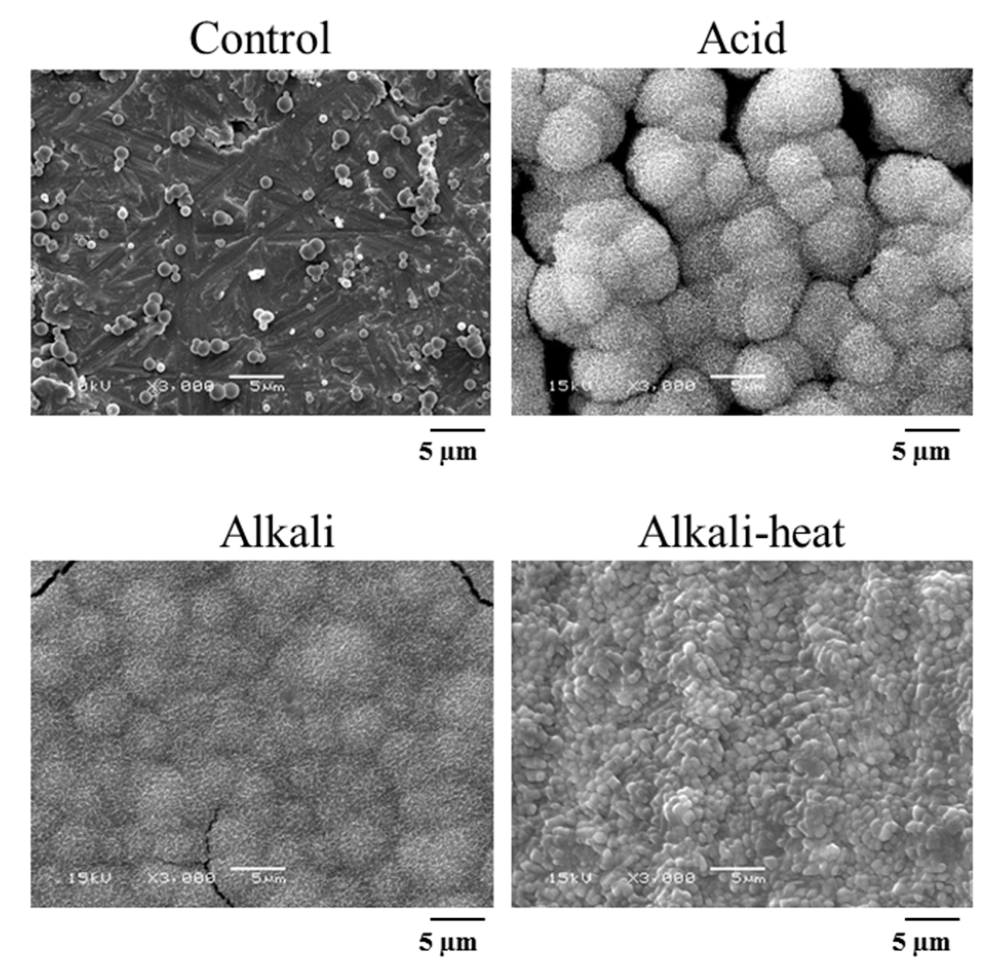 Metals 09 00230 g007