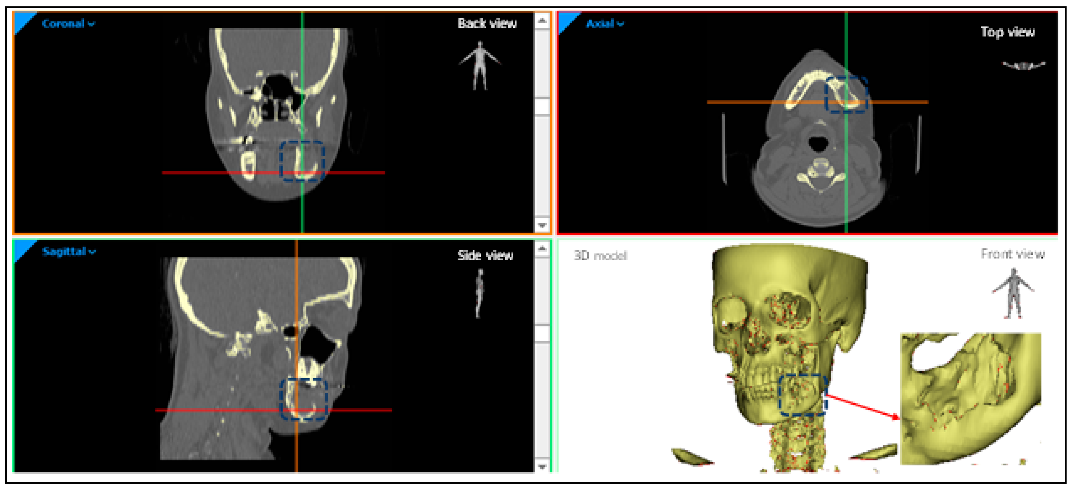 Metals 09 00569 g002