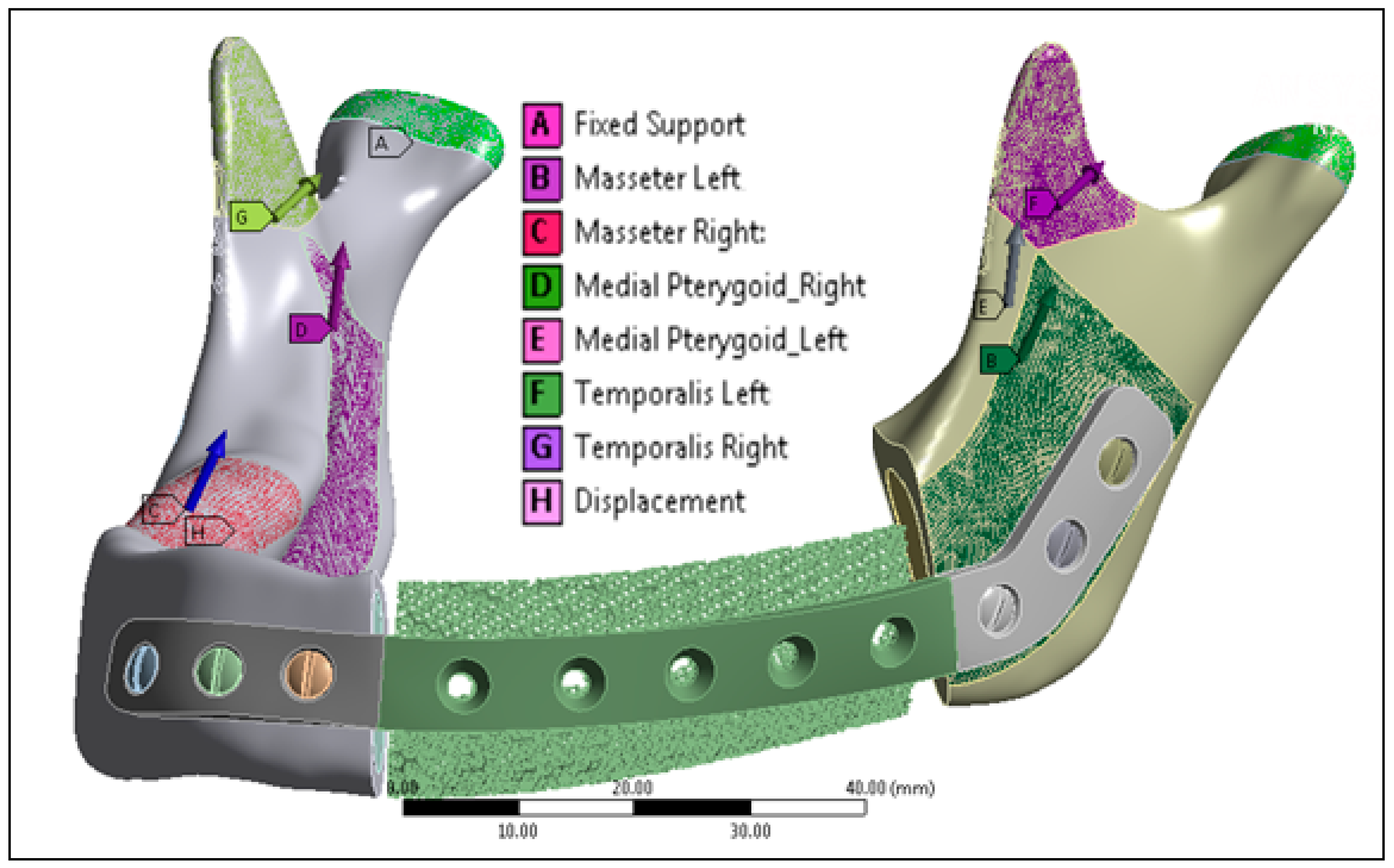 Metals 09 00569 g006