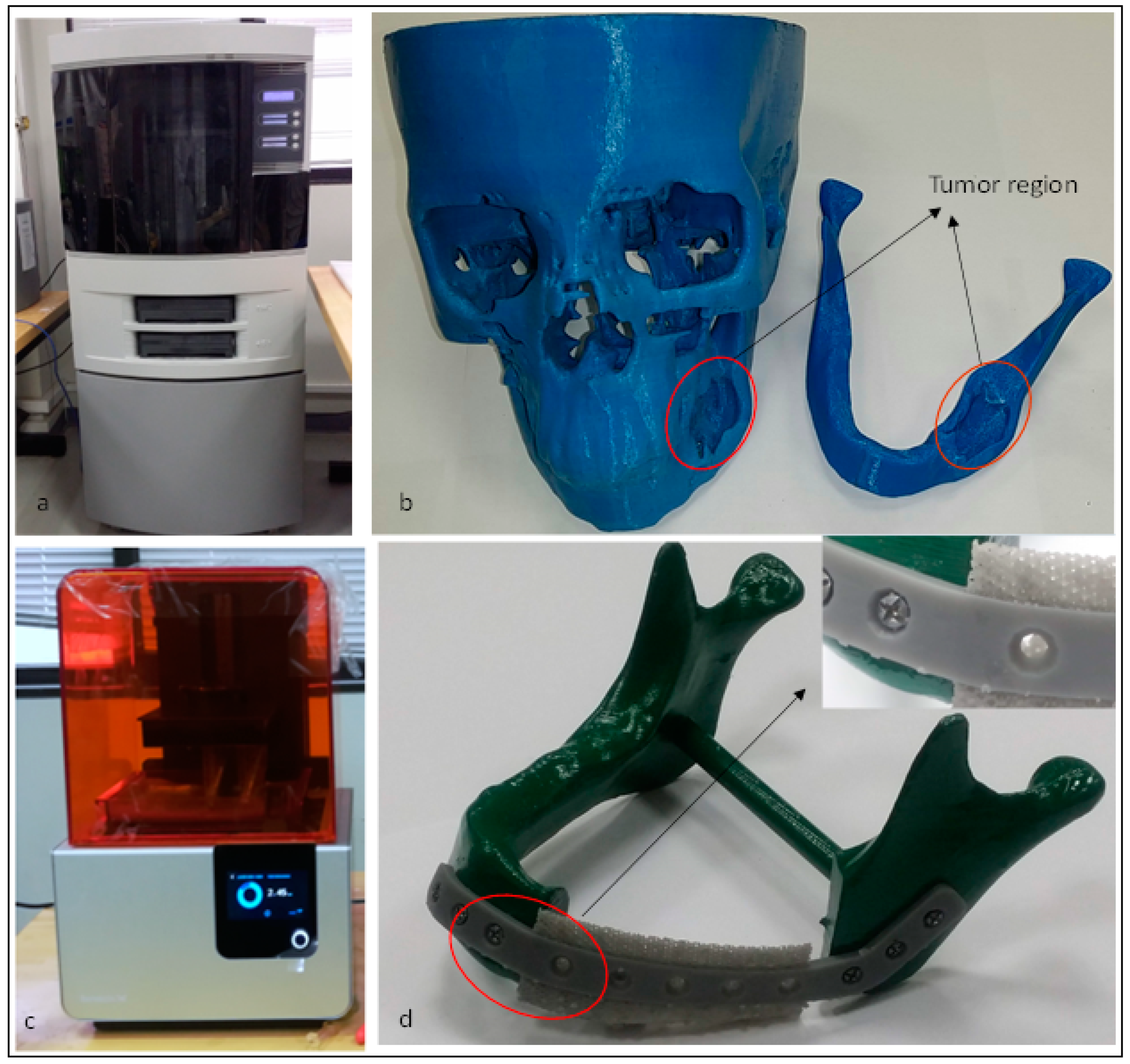 Metals 09 00569 g008