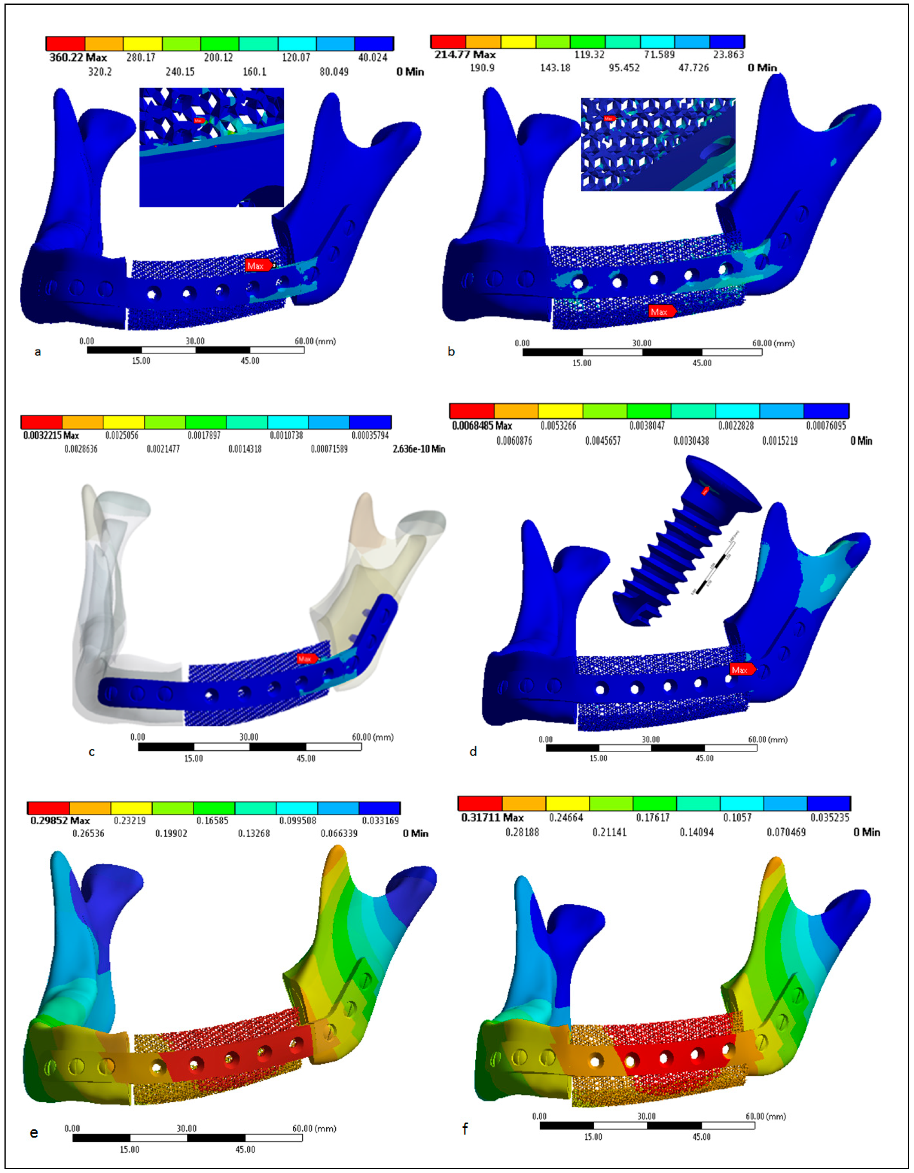 Metals 09 00569 g014