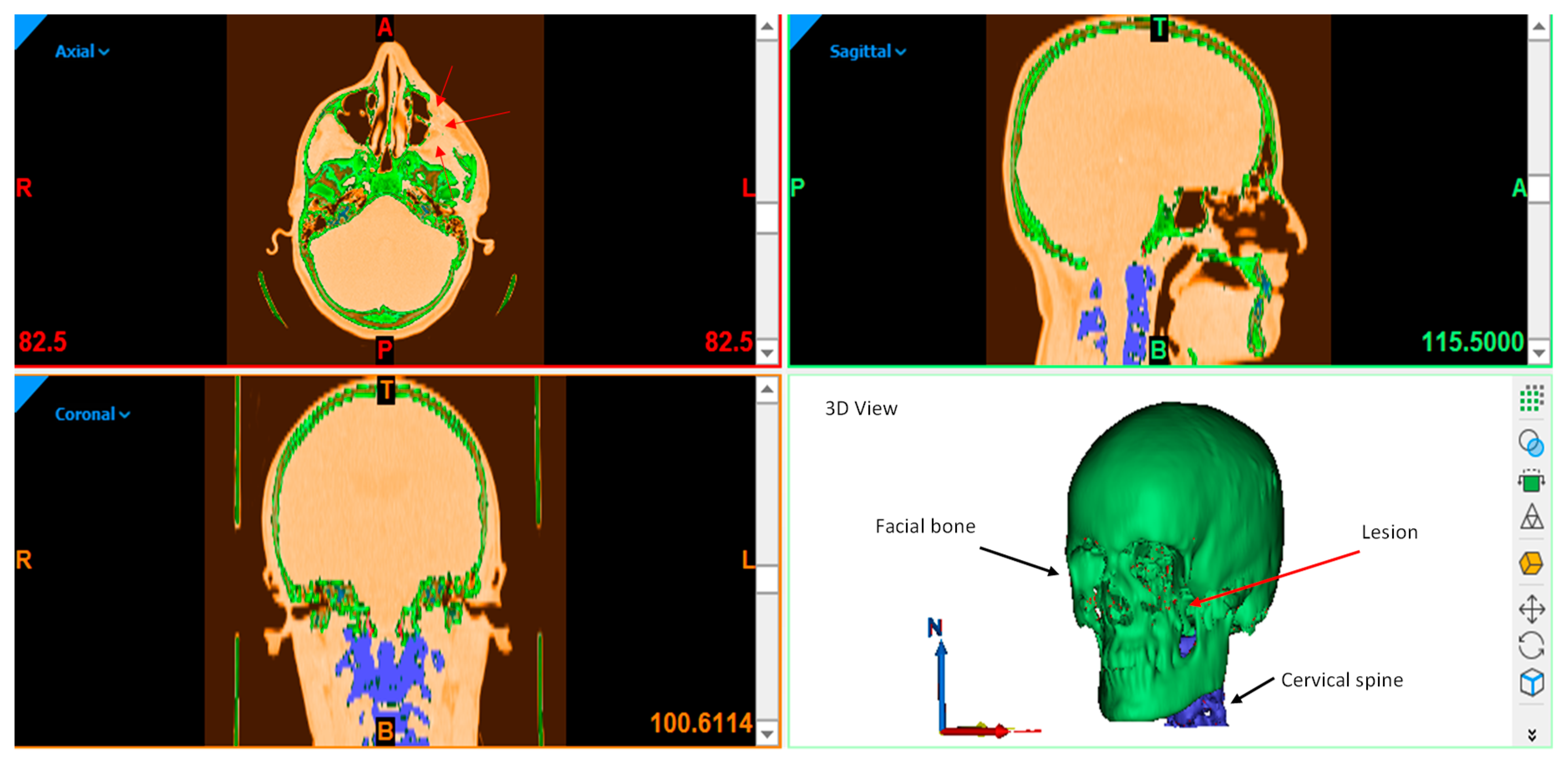 Metals 09 01250 g002