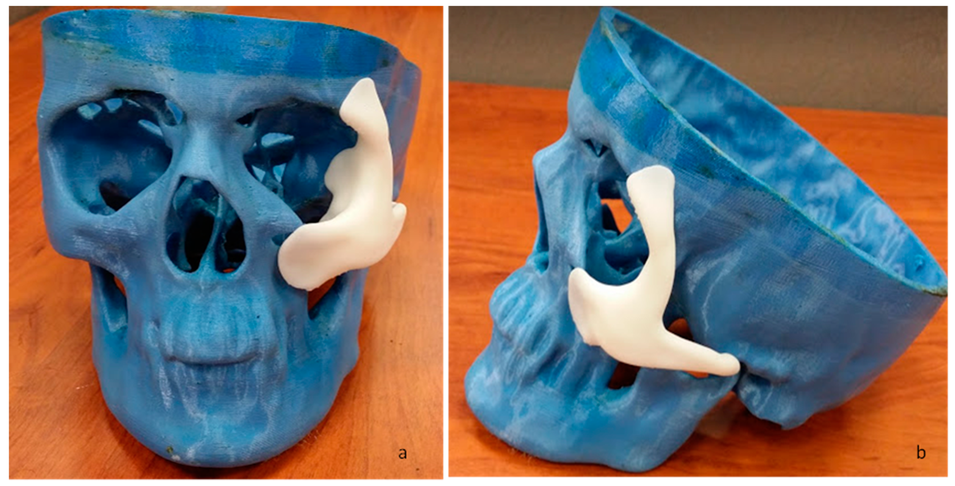 Metals 09 01250 g006