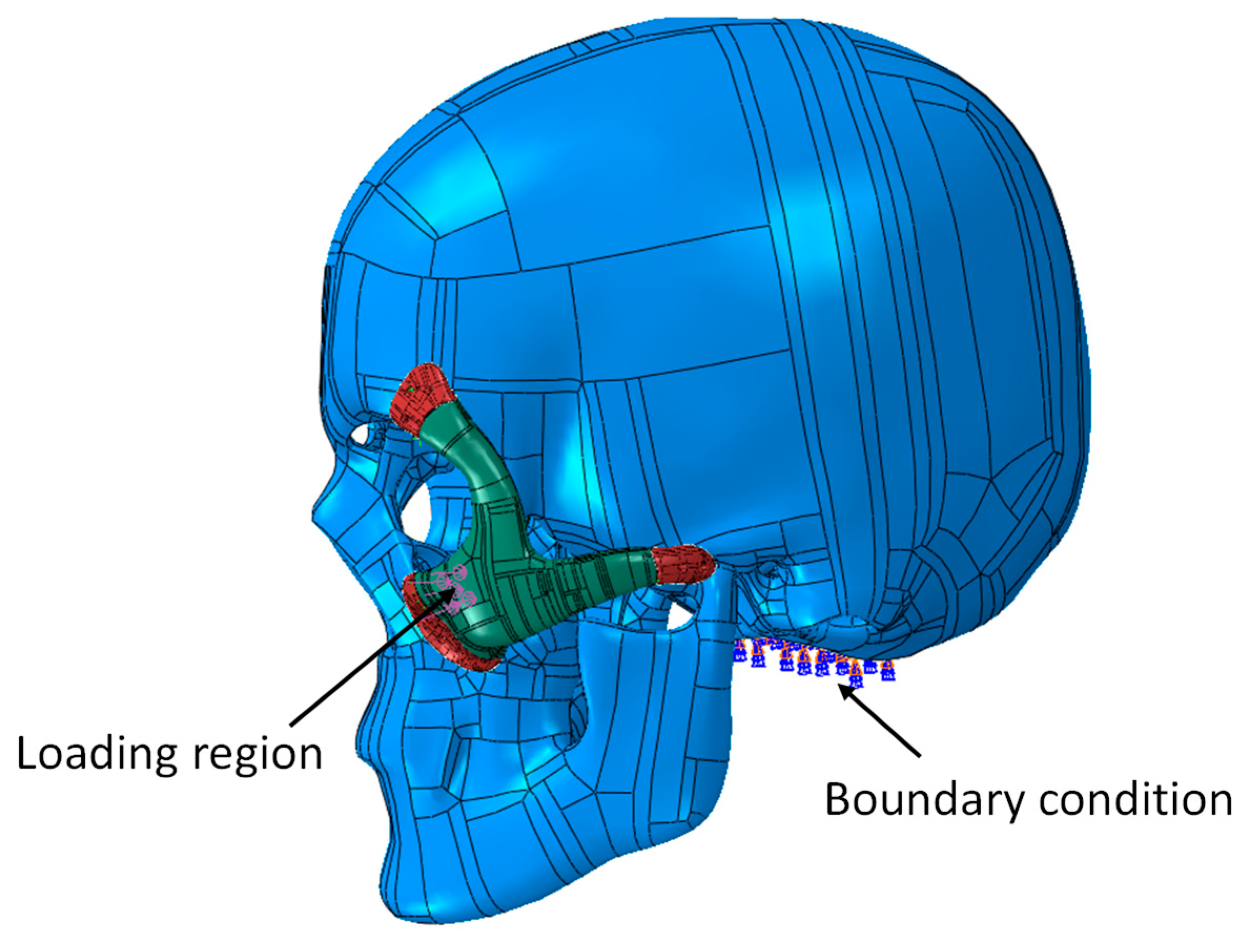 Metals 09 01250 g010