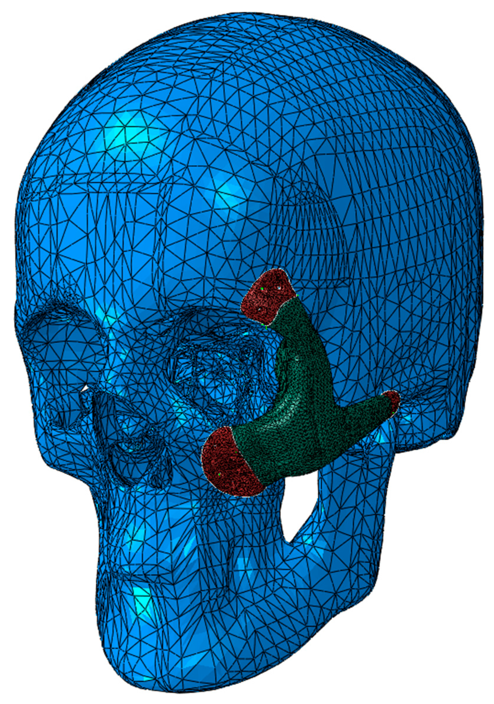 Metals 09 01250 g011