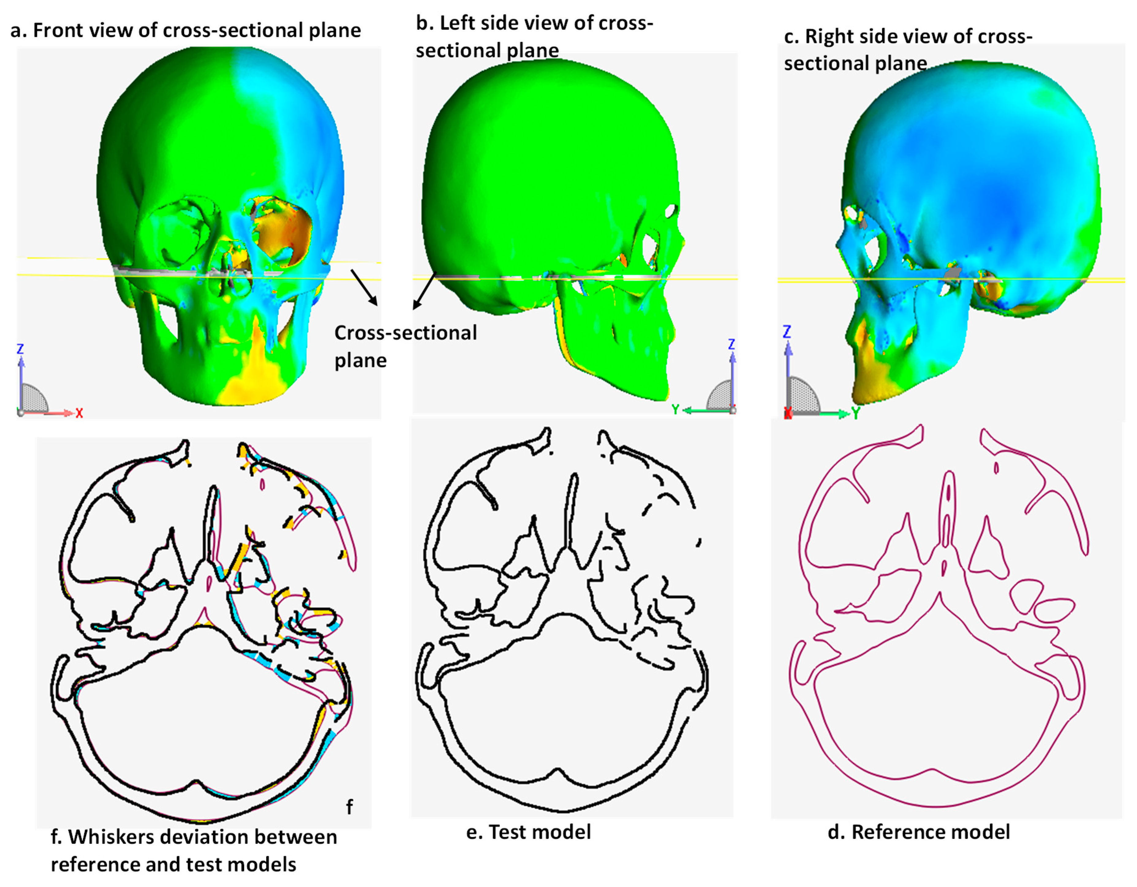 Metals 09 01250 g013