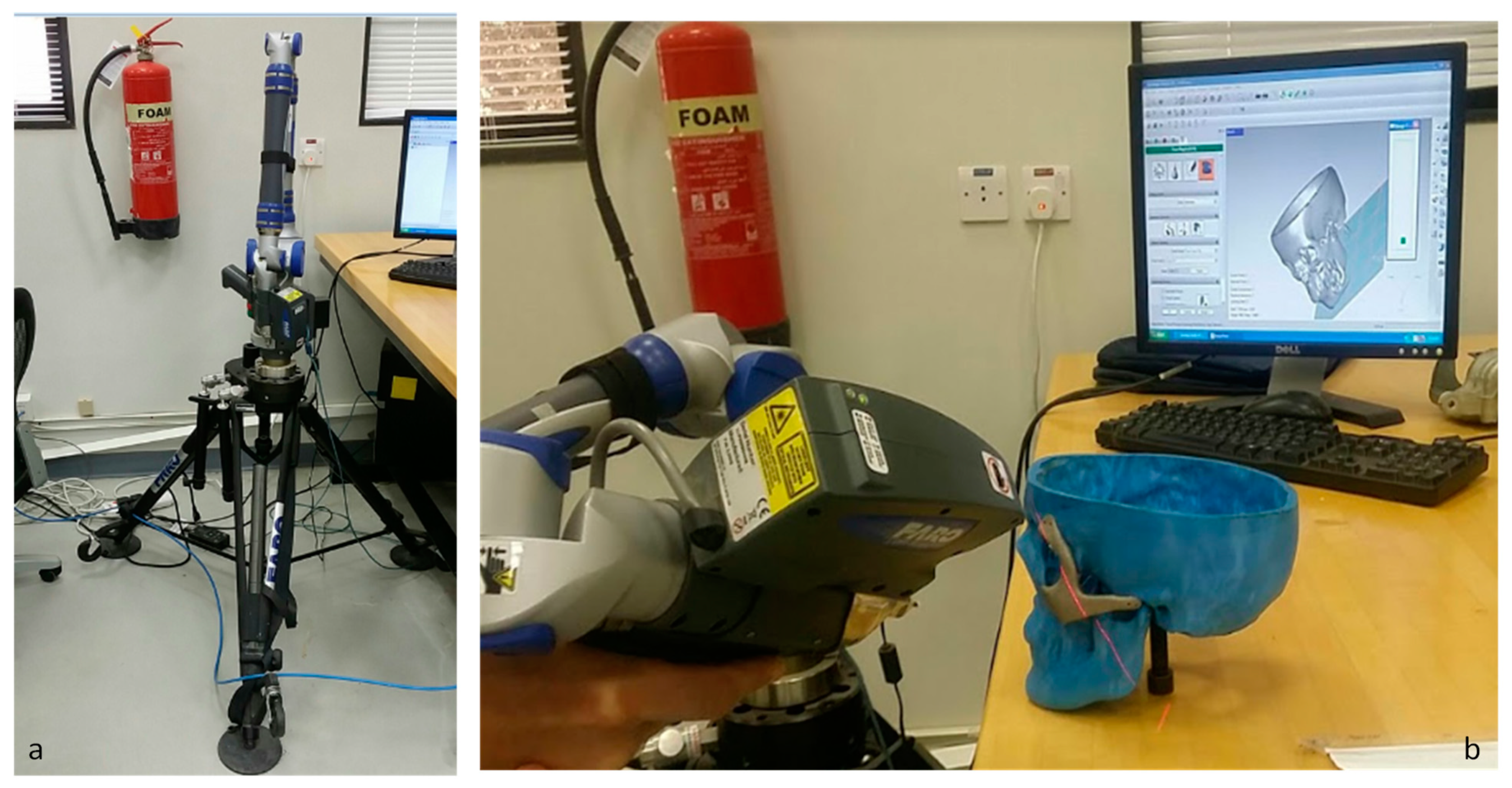 Metals 09 01250 g014