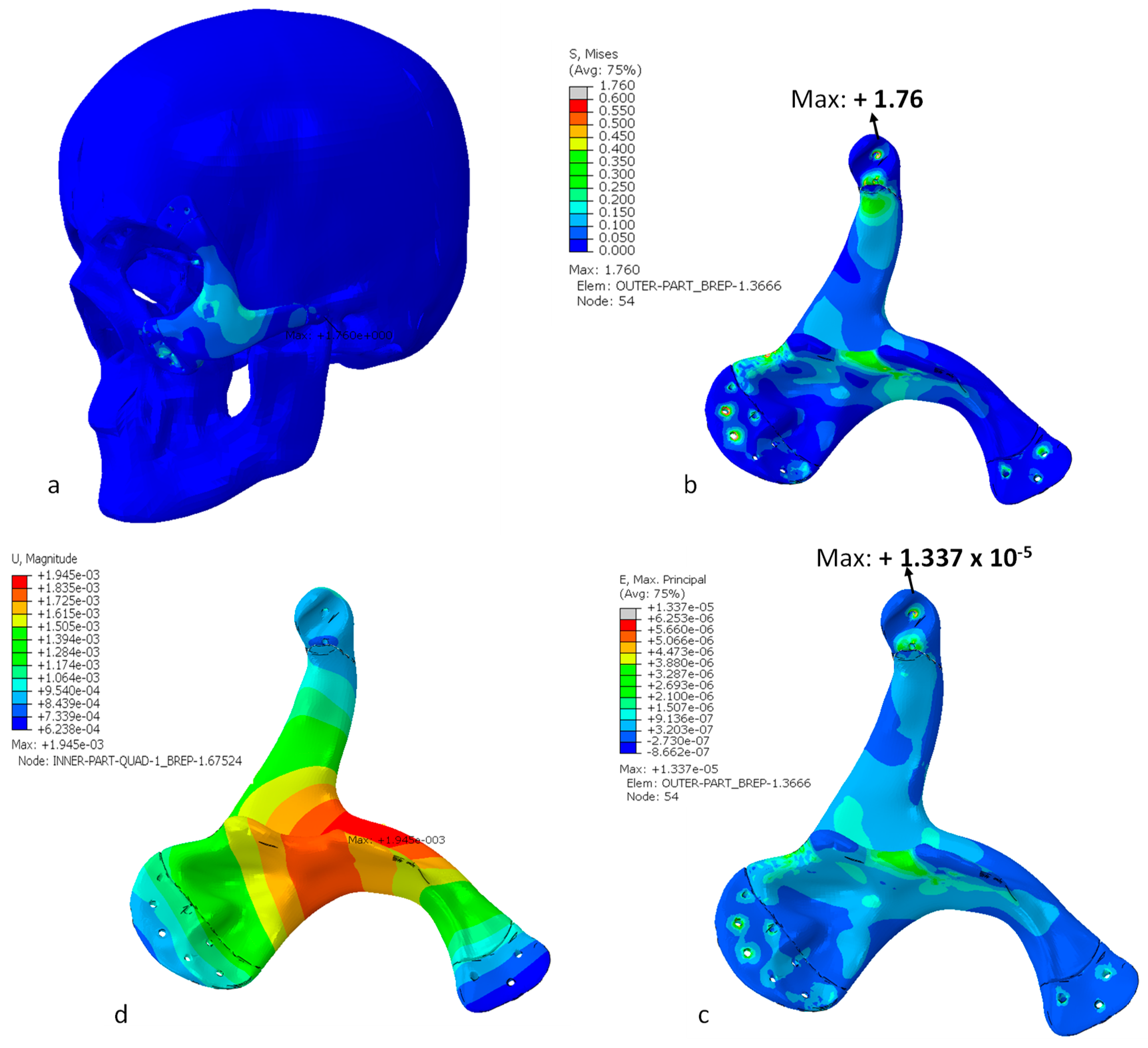 Metals 09 01250 g015