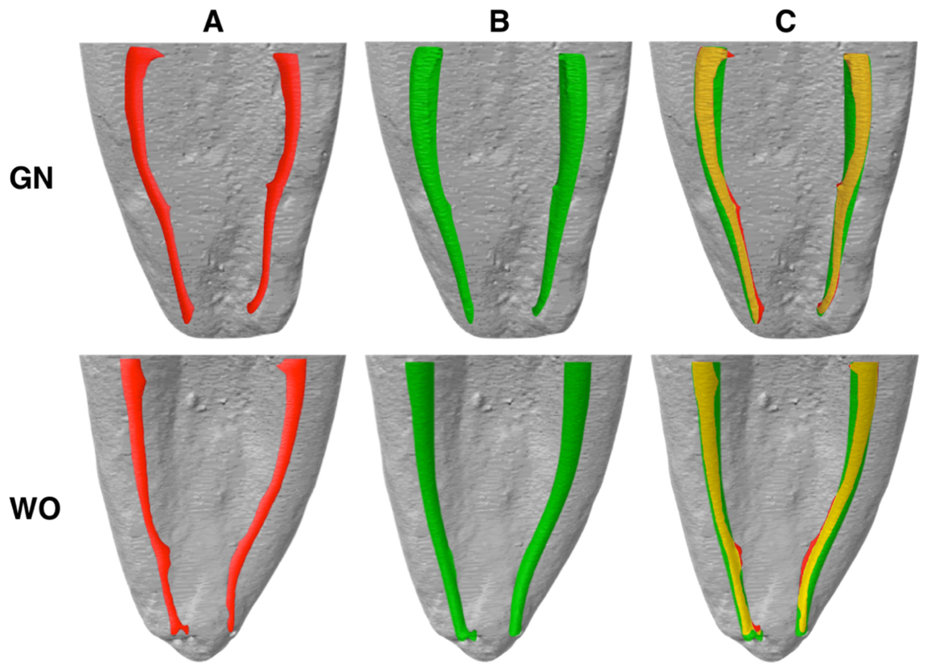 Metals 10 00172 g003