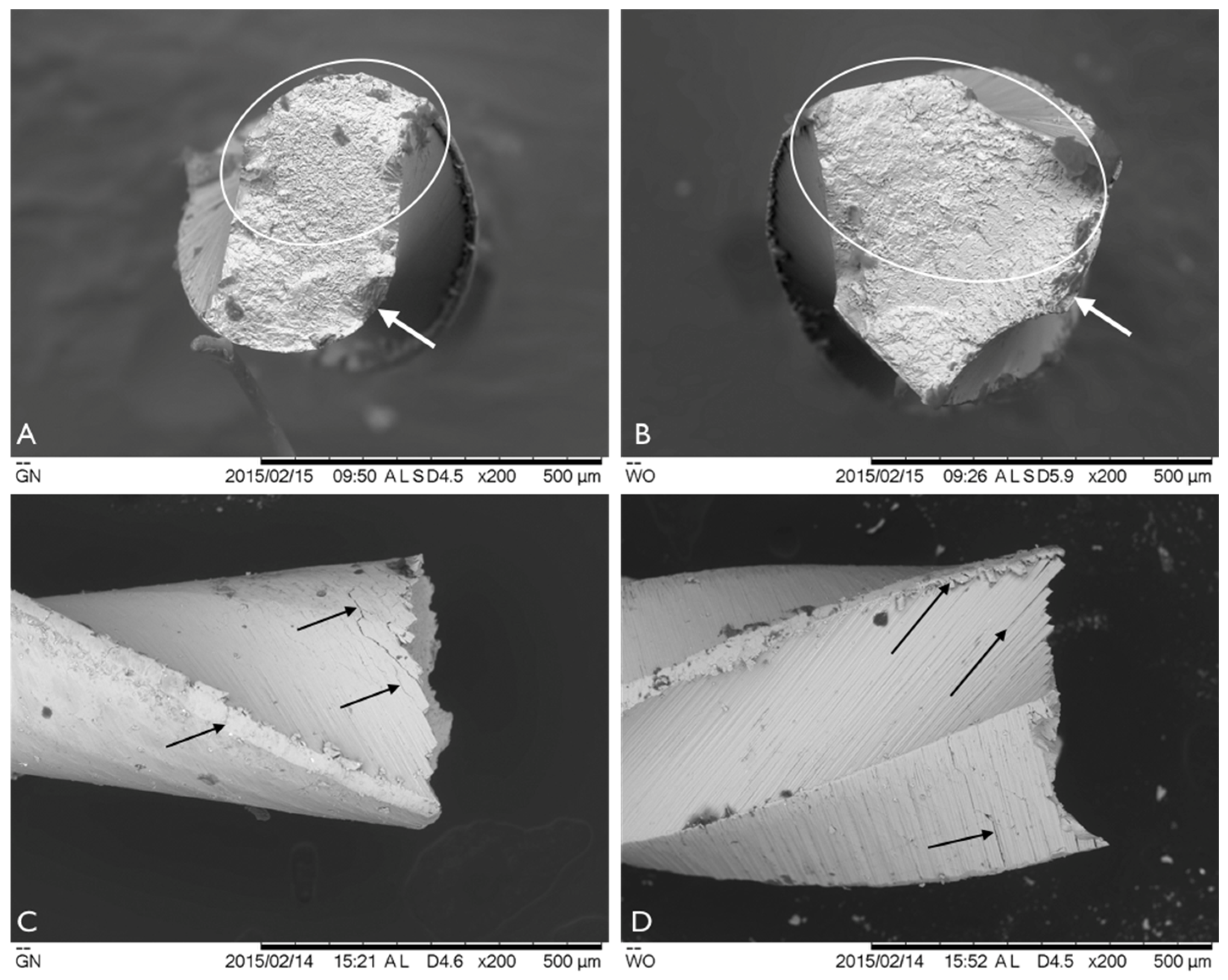 Metals 10 00172 g005
