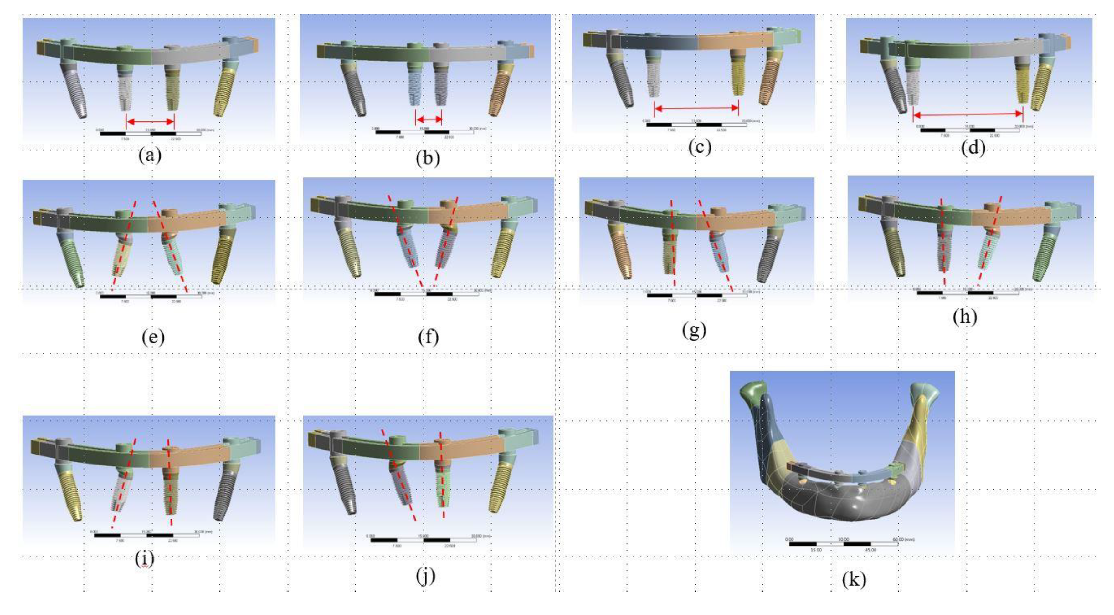 Metals 10 00280 g001 Metals 10 00280 g001