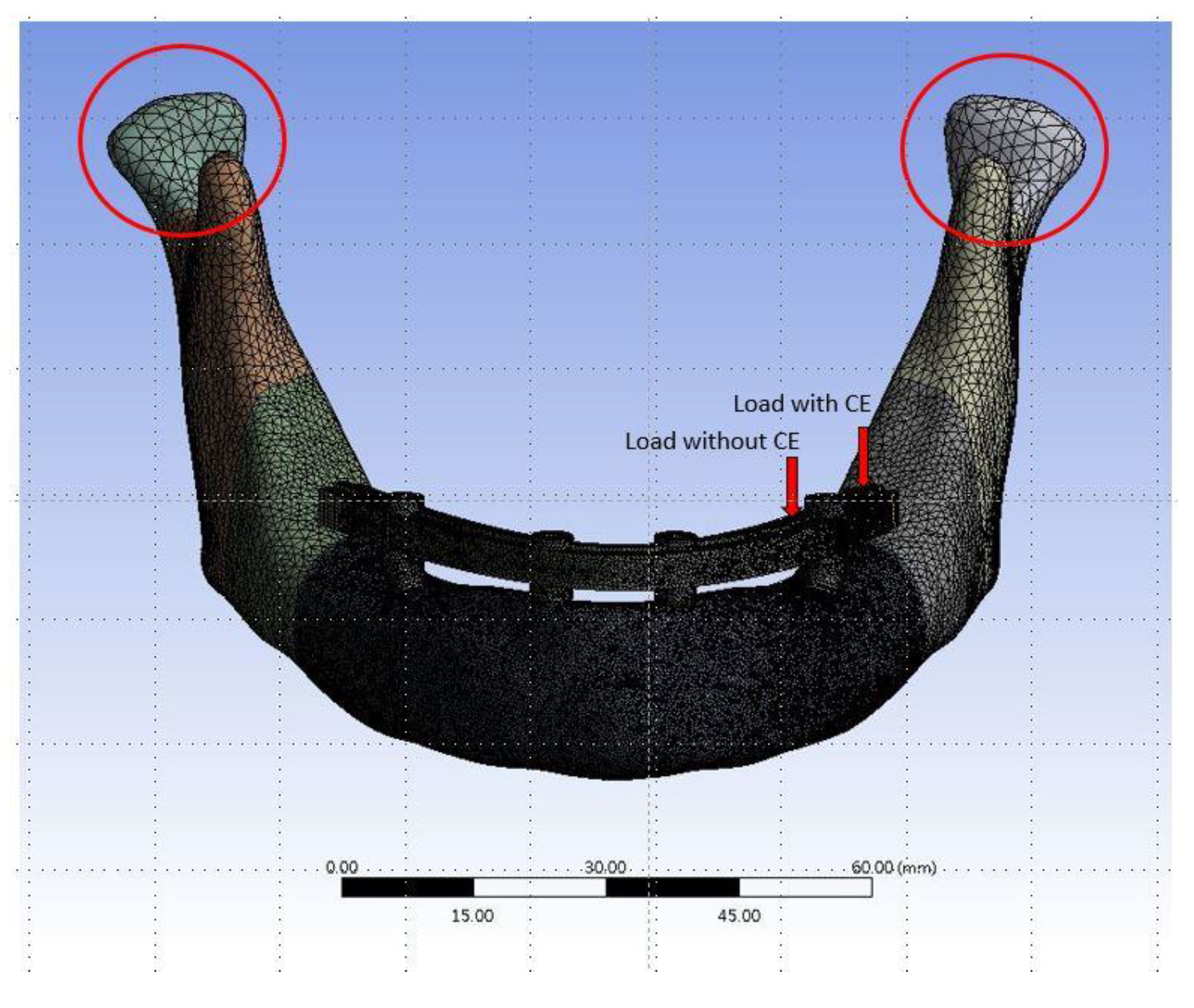 Metals 10 00280 g002 Metals 10 00280 g002