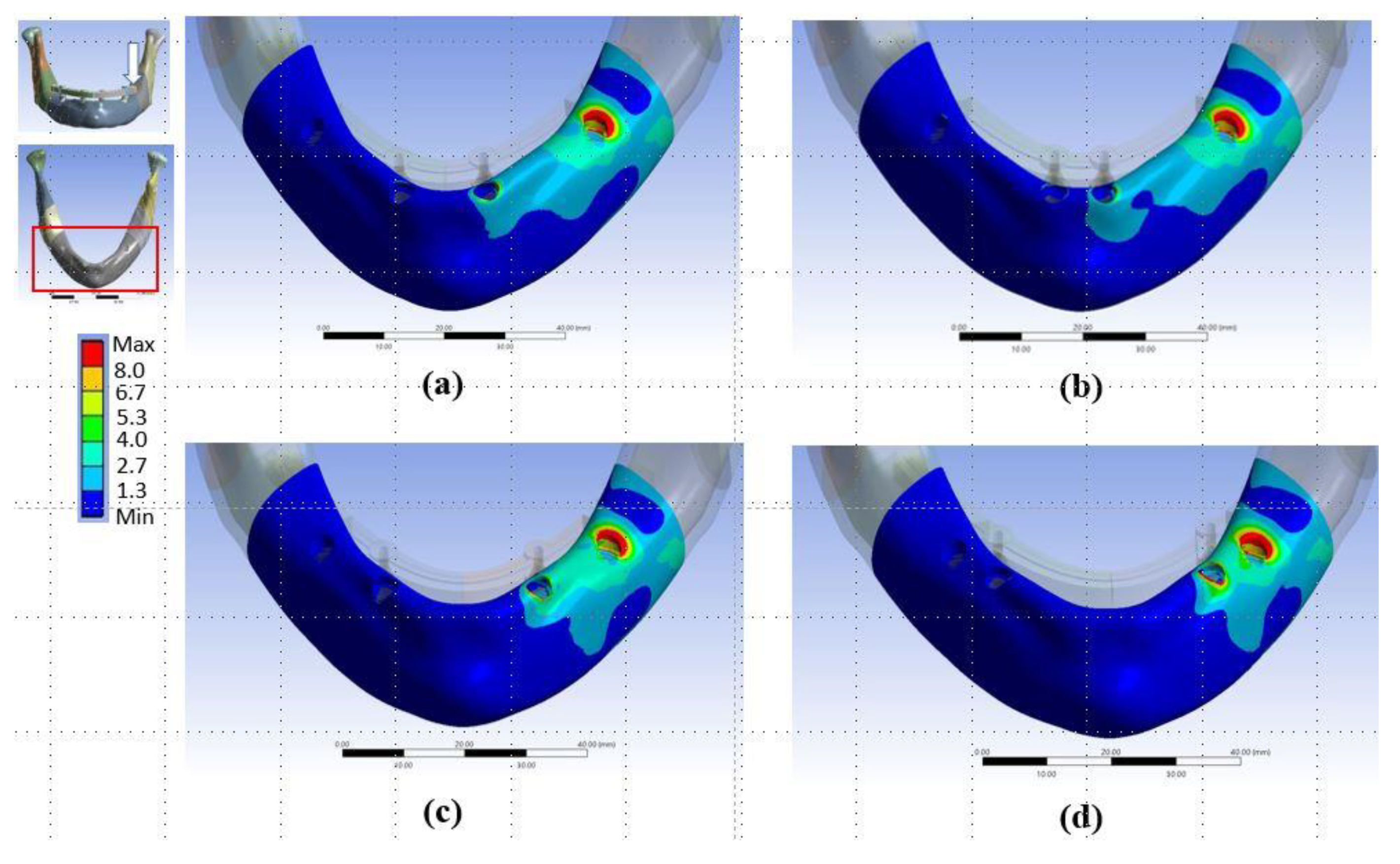 Metals 10 00280 g005 Metals 10 00280 g005