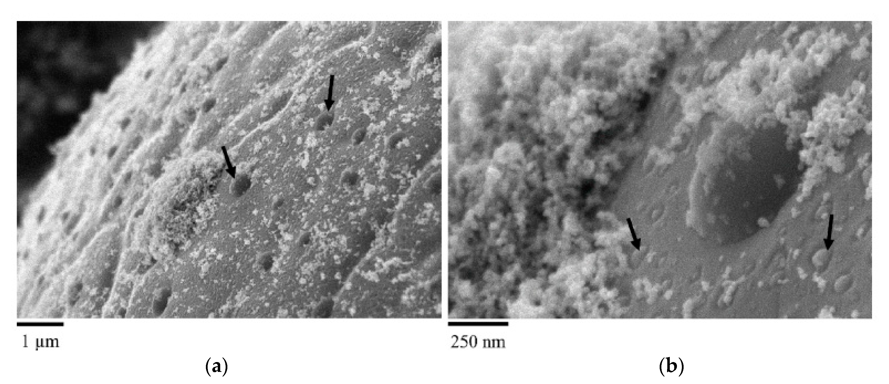 Metals 10 00341 g008