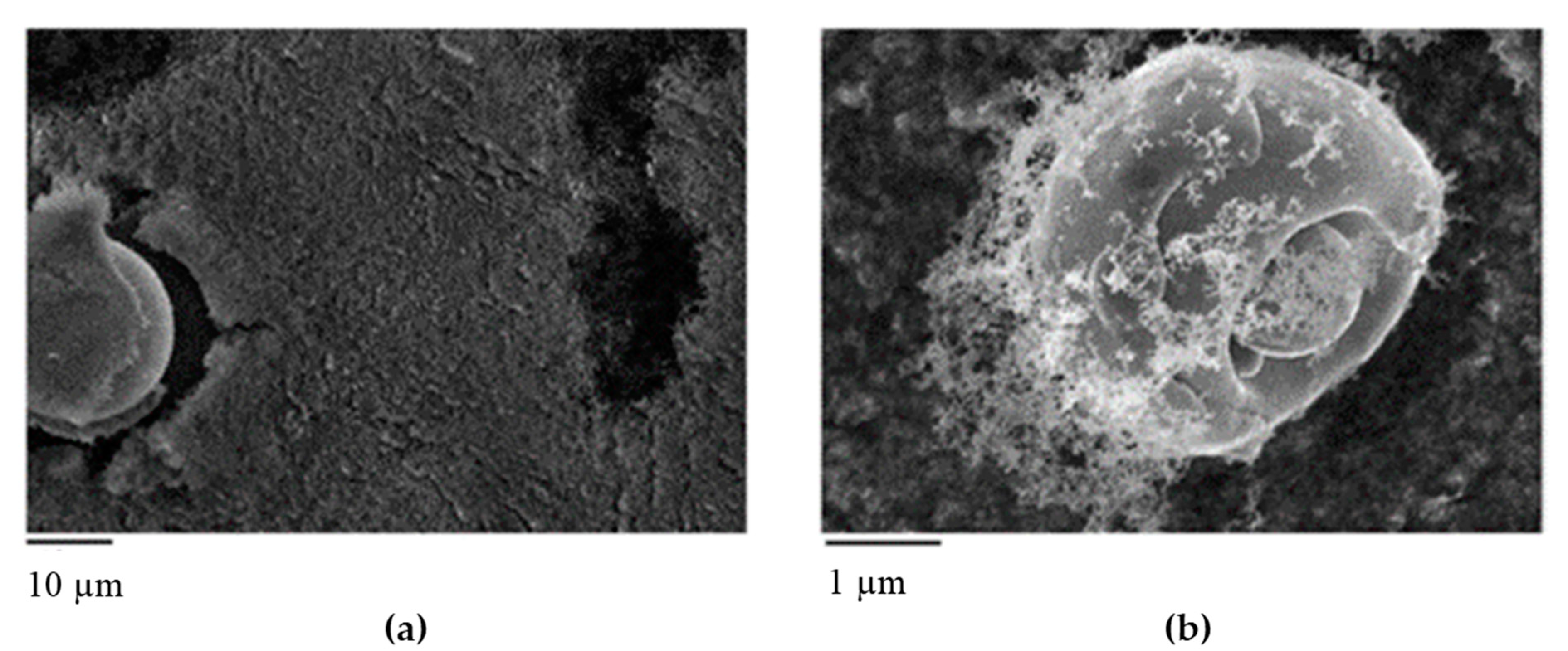 Metals 10 00341 g010