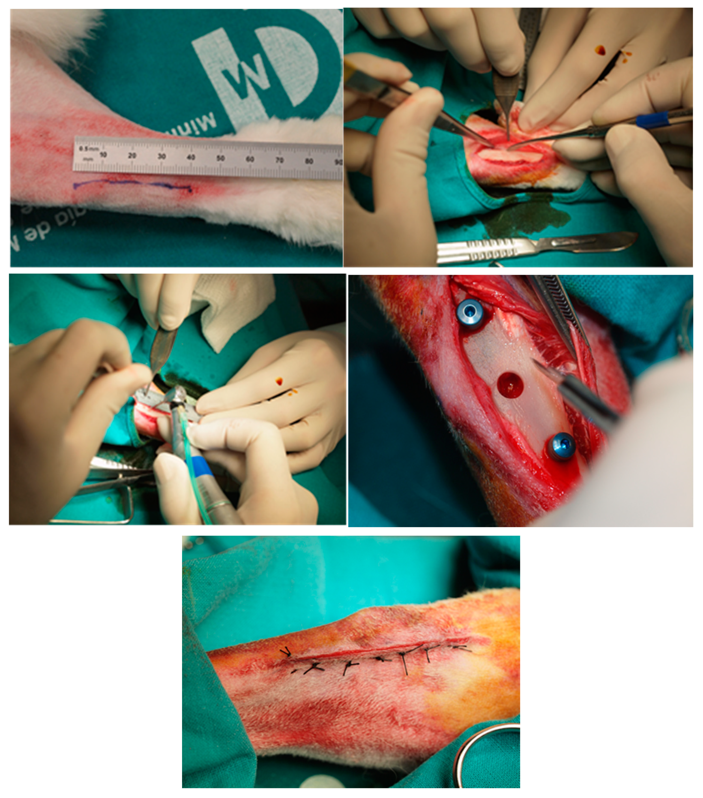 Metals 10 00449 g001