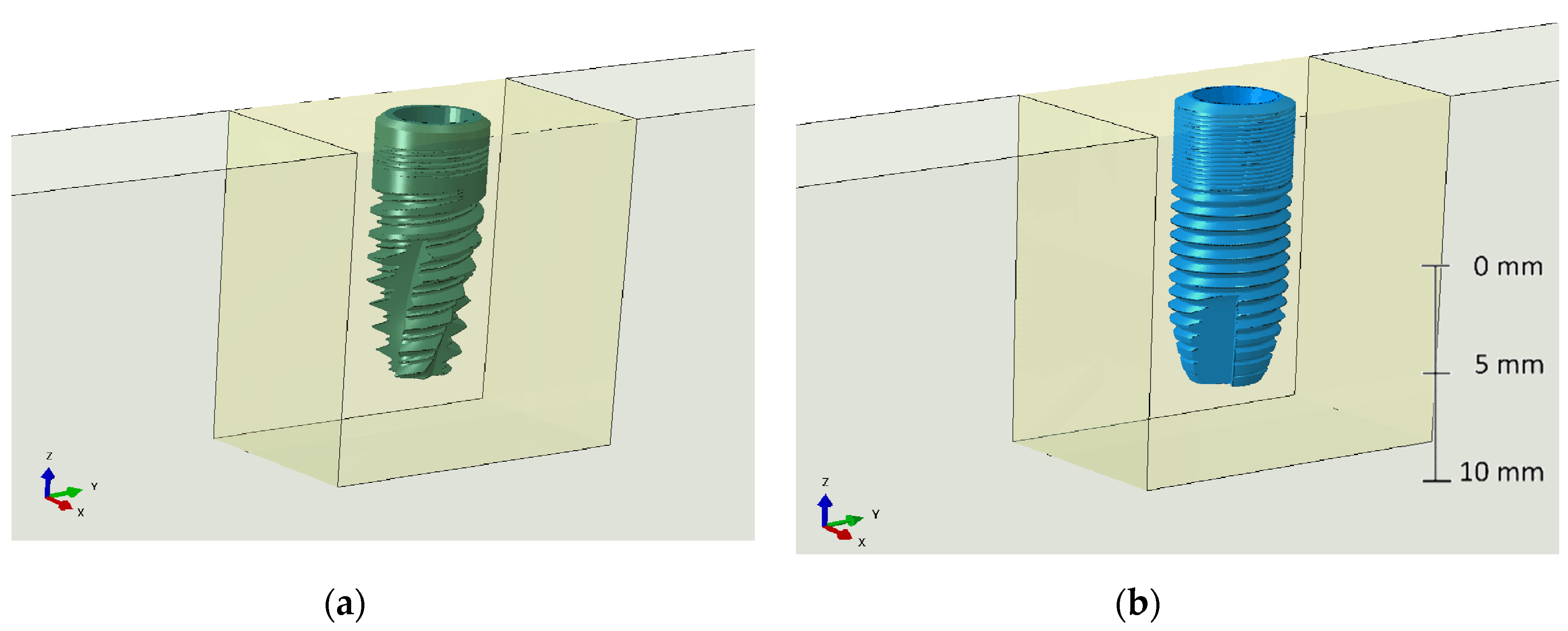 Metals 10 00648 g001